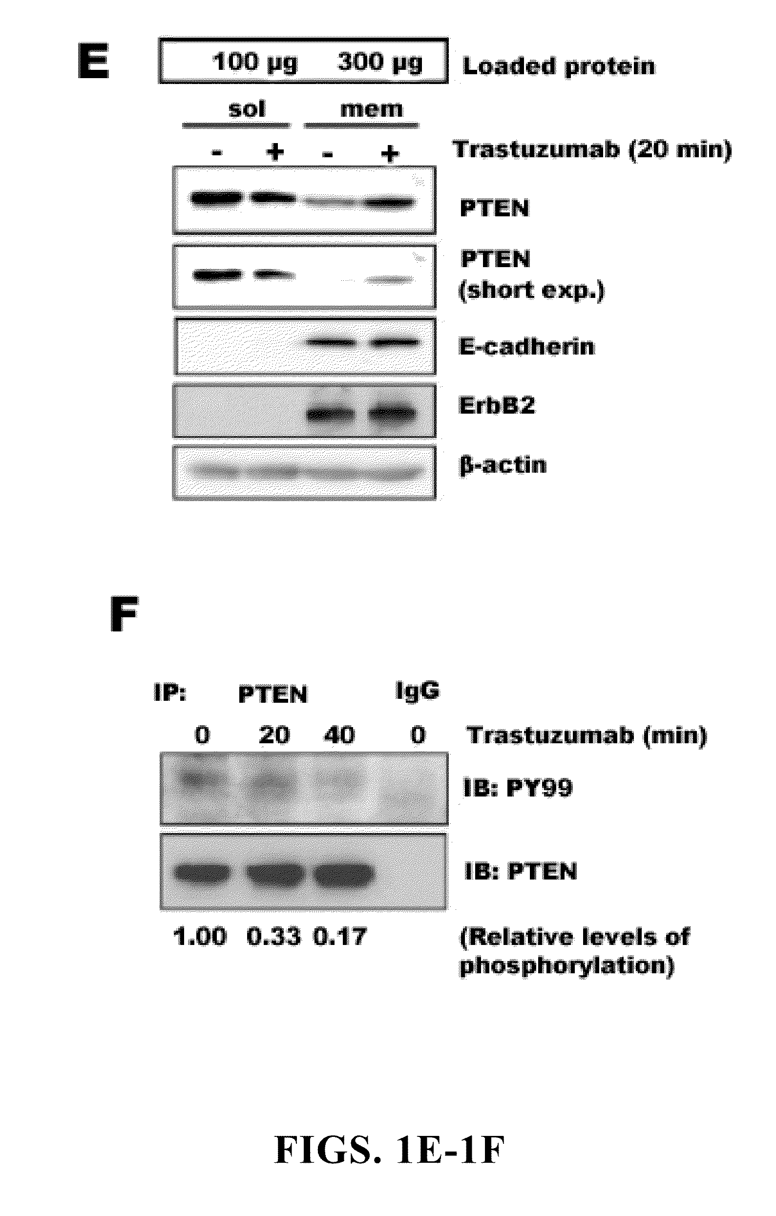 Diagnostic and therapeutic methods and compositions involving pten and breast cancer