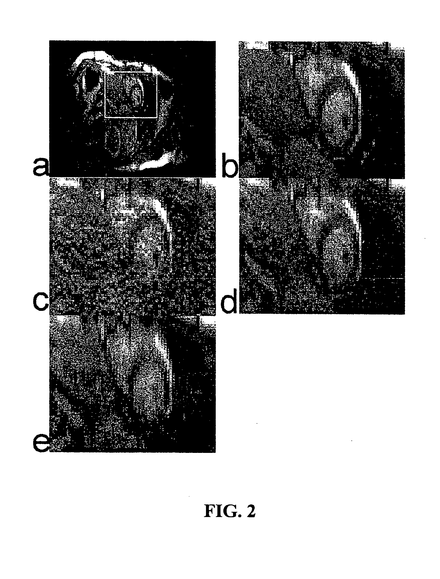 Method and Apparatus for Parameter Free Regularized Partially Parallel Imaging Using Magnetic Resonance Imaging