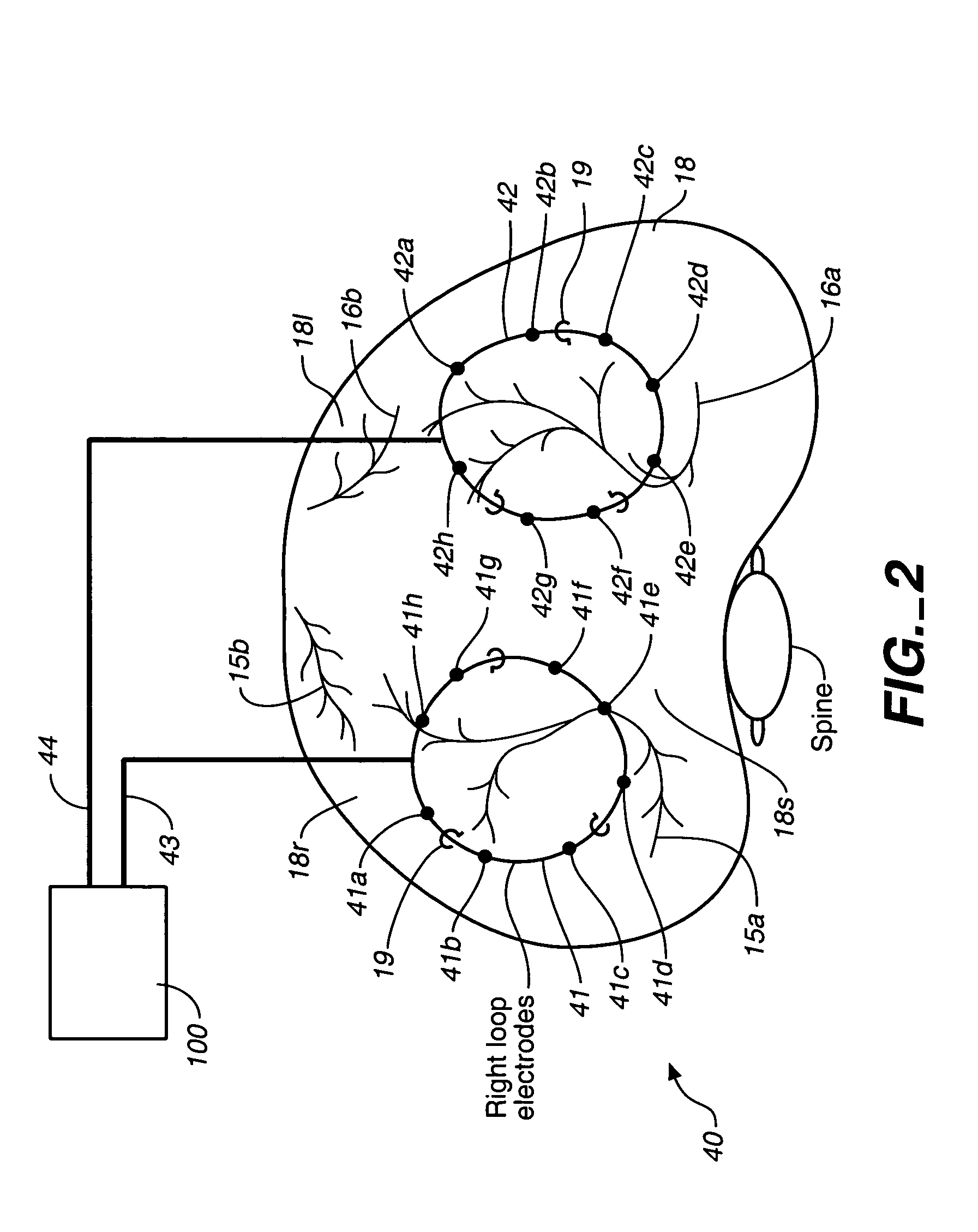 Breathing disorder detection and therapy delivery device and method