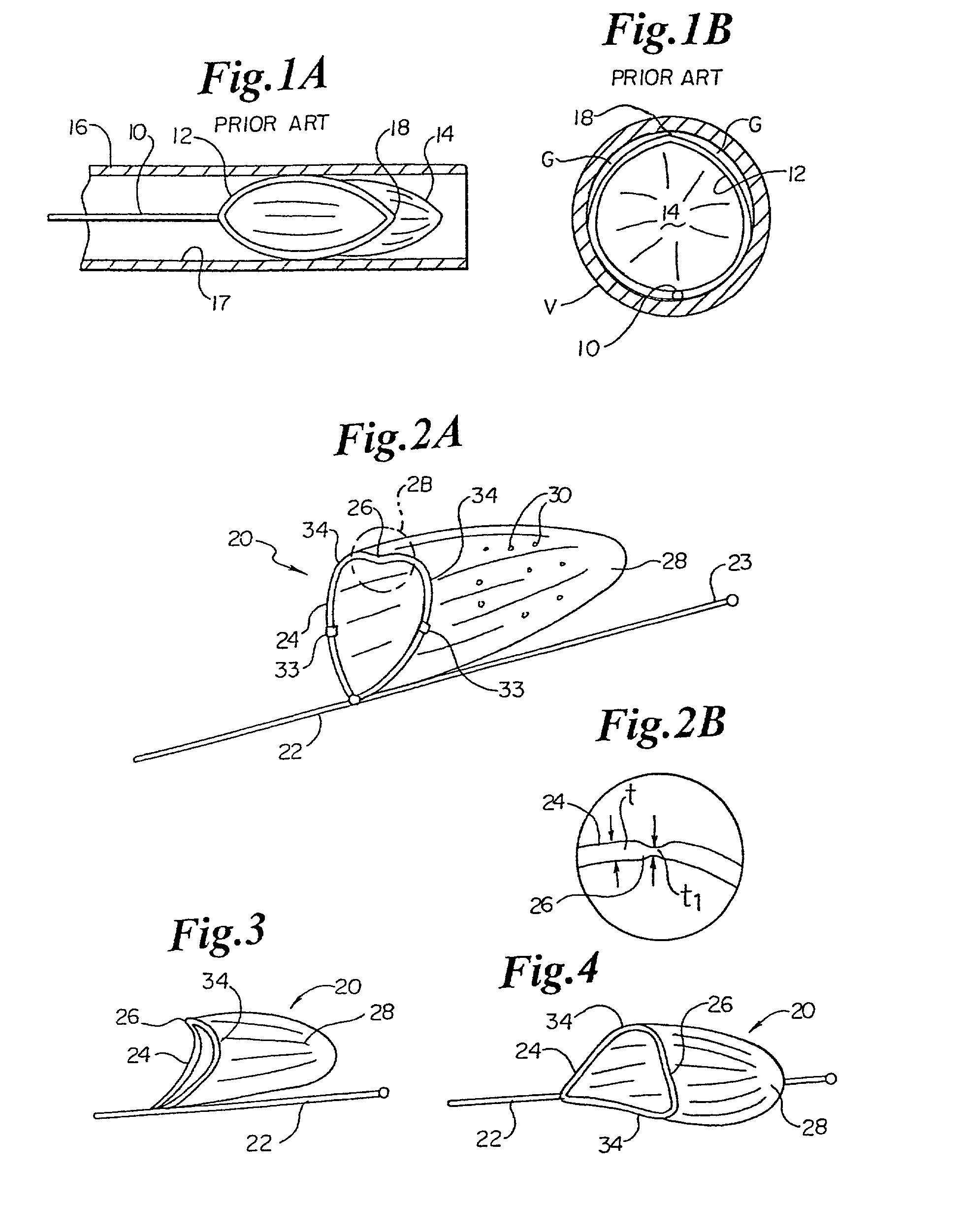 Vascular device for emboli and thrombi removal and methods of use