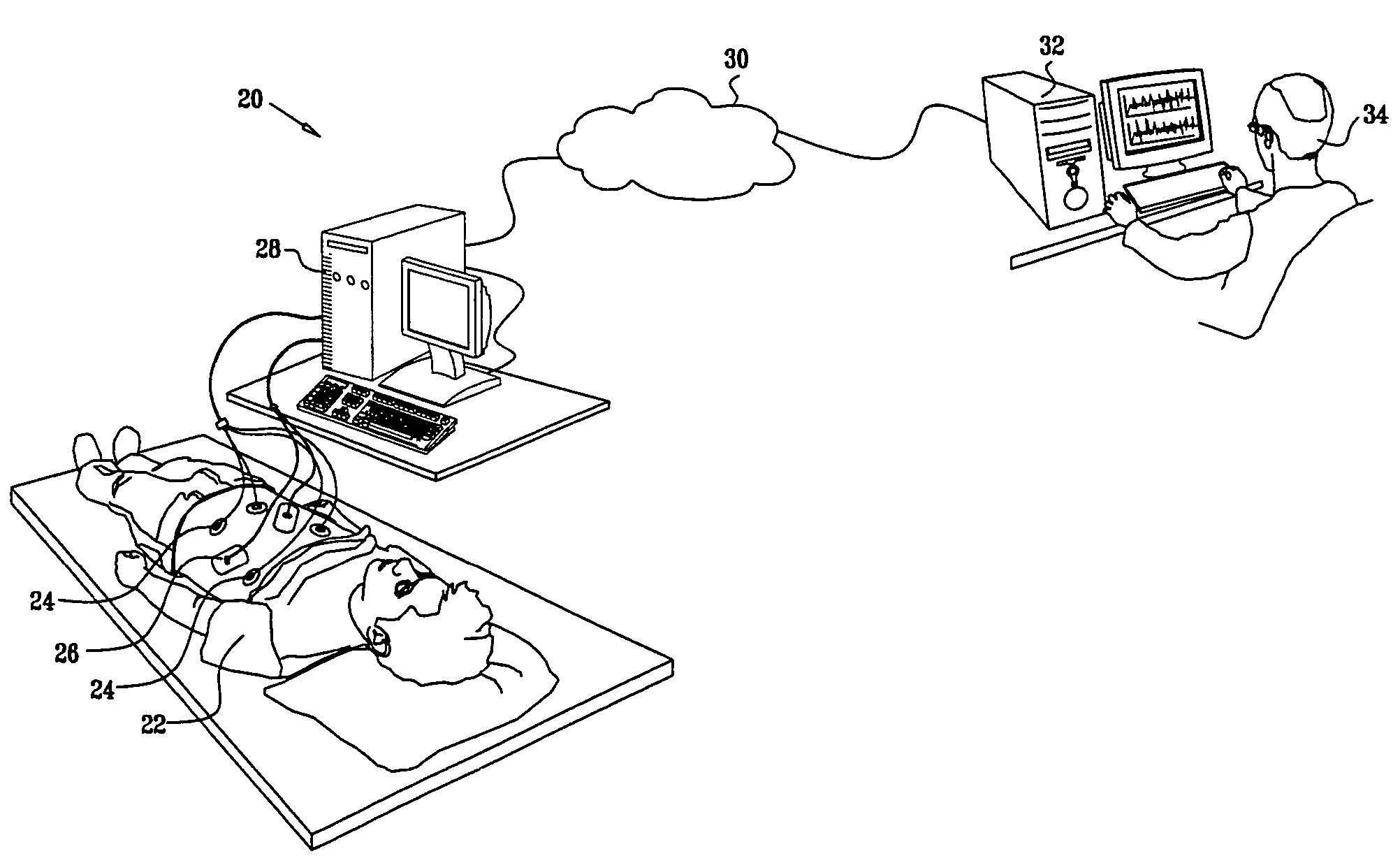 Sleep staging based on cardio-respiratory signals