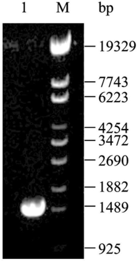 Succinic acid genetic engineering bacterium and method for fermenting and producing succinic acid