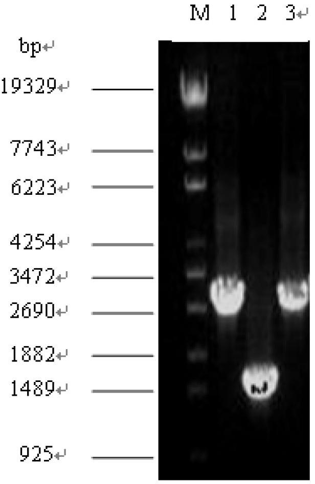 Succinic acid genetic engineering bacterium and method for fermenting and producing succinic acid