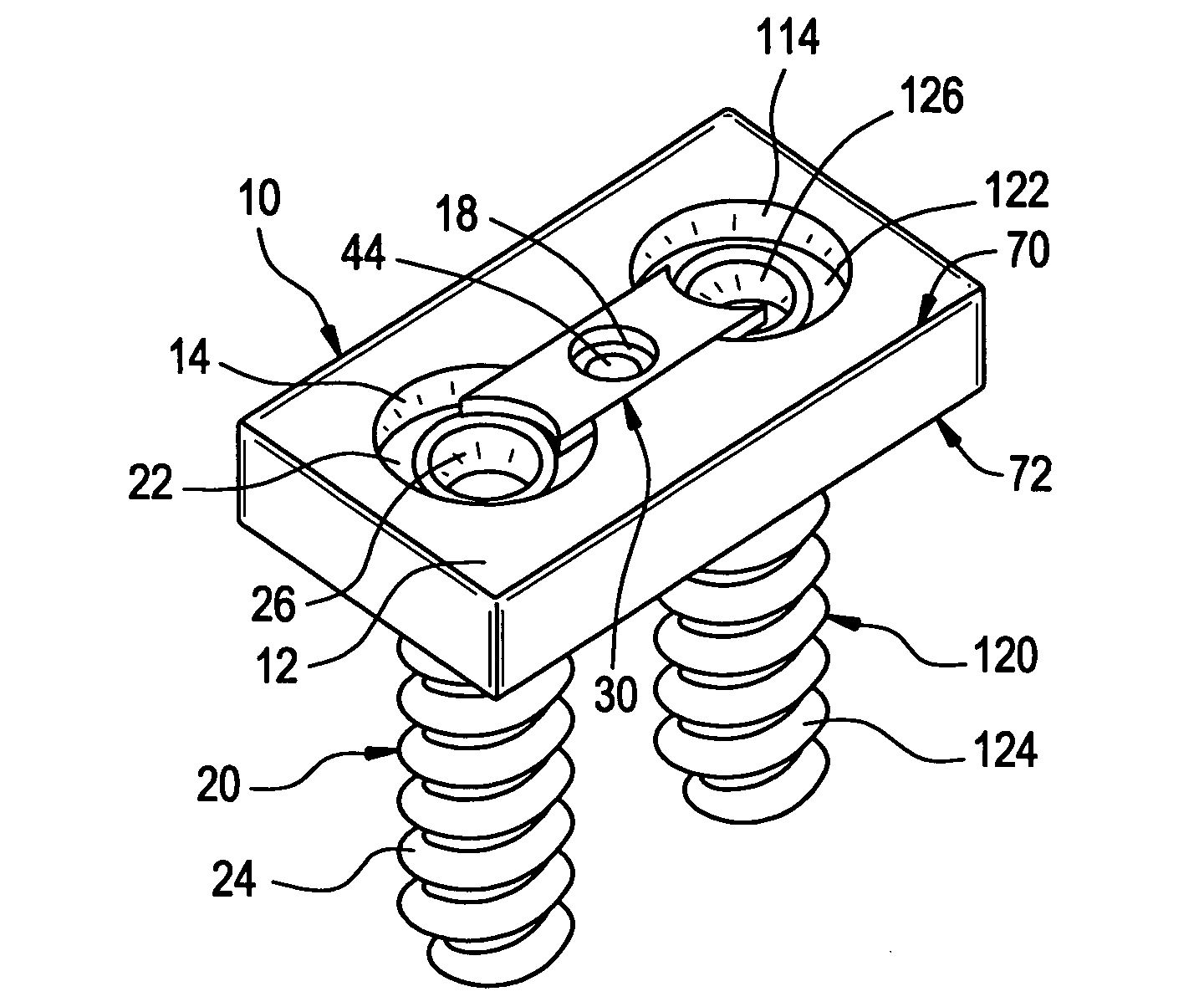 Apparatus for retaining a bone anchor in a bone plate and method for use thereof