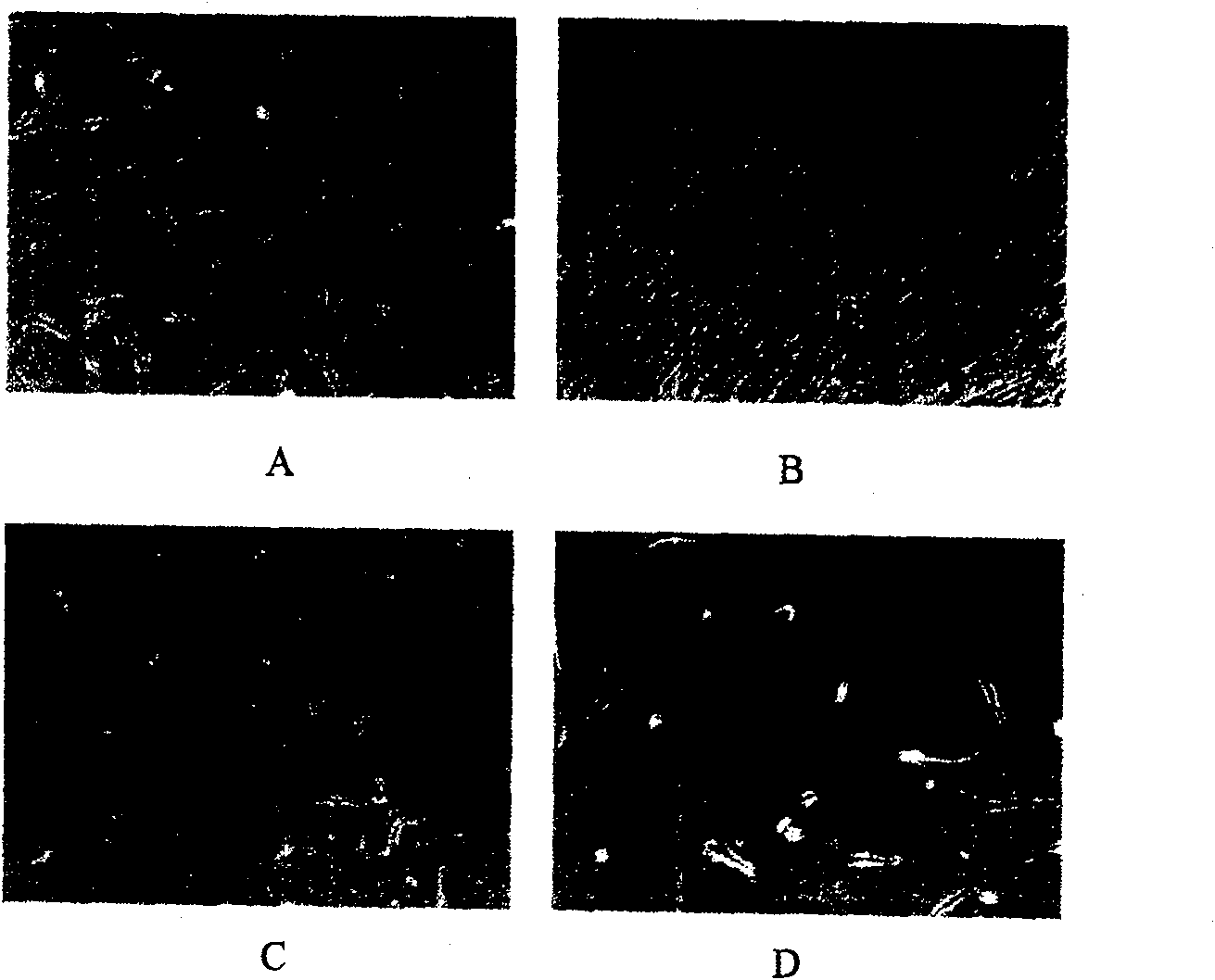 Method for sorting human marrow mesenchymal stemcell by monoclonal antibody ZUF10 immunomagnetic bead