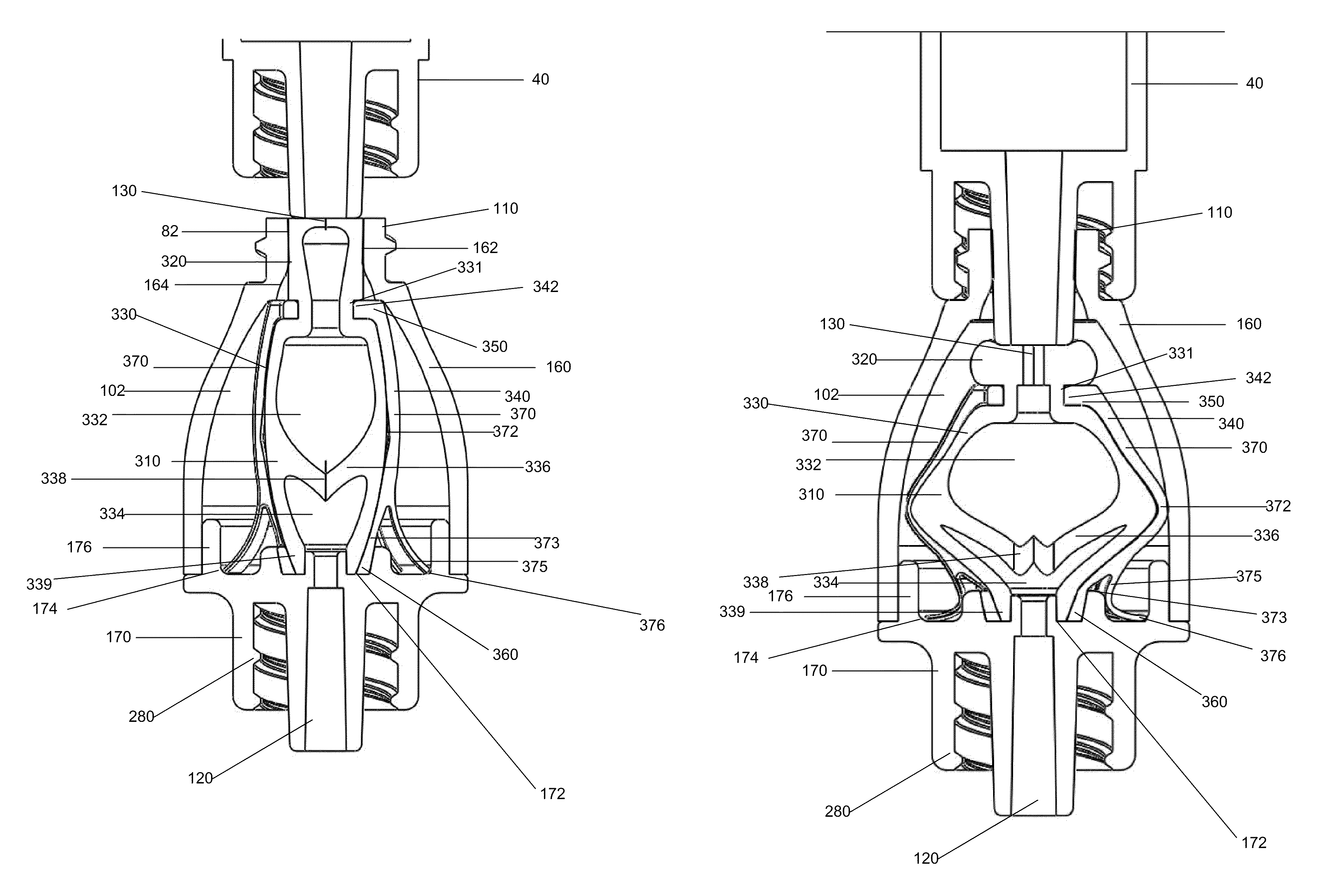 Medical valve with fluid volume alteration
