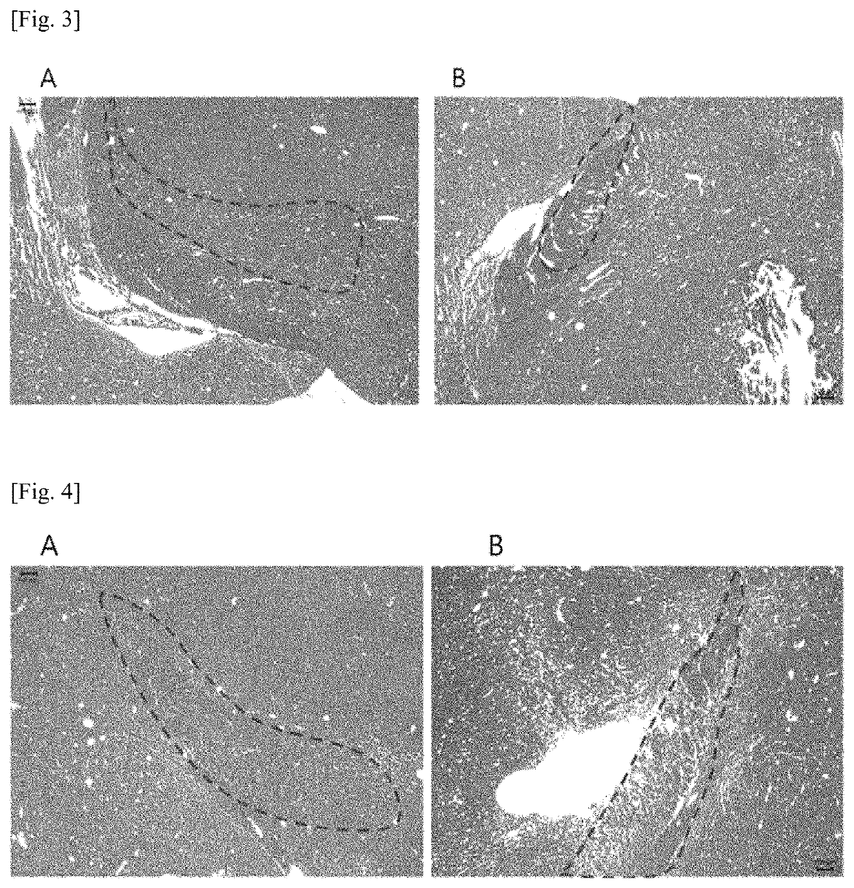 miRNA as biomarker for Parkinson's disease and diagnostic kit using same