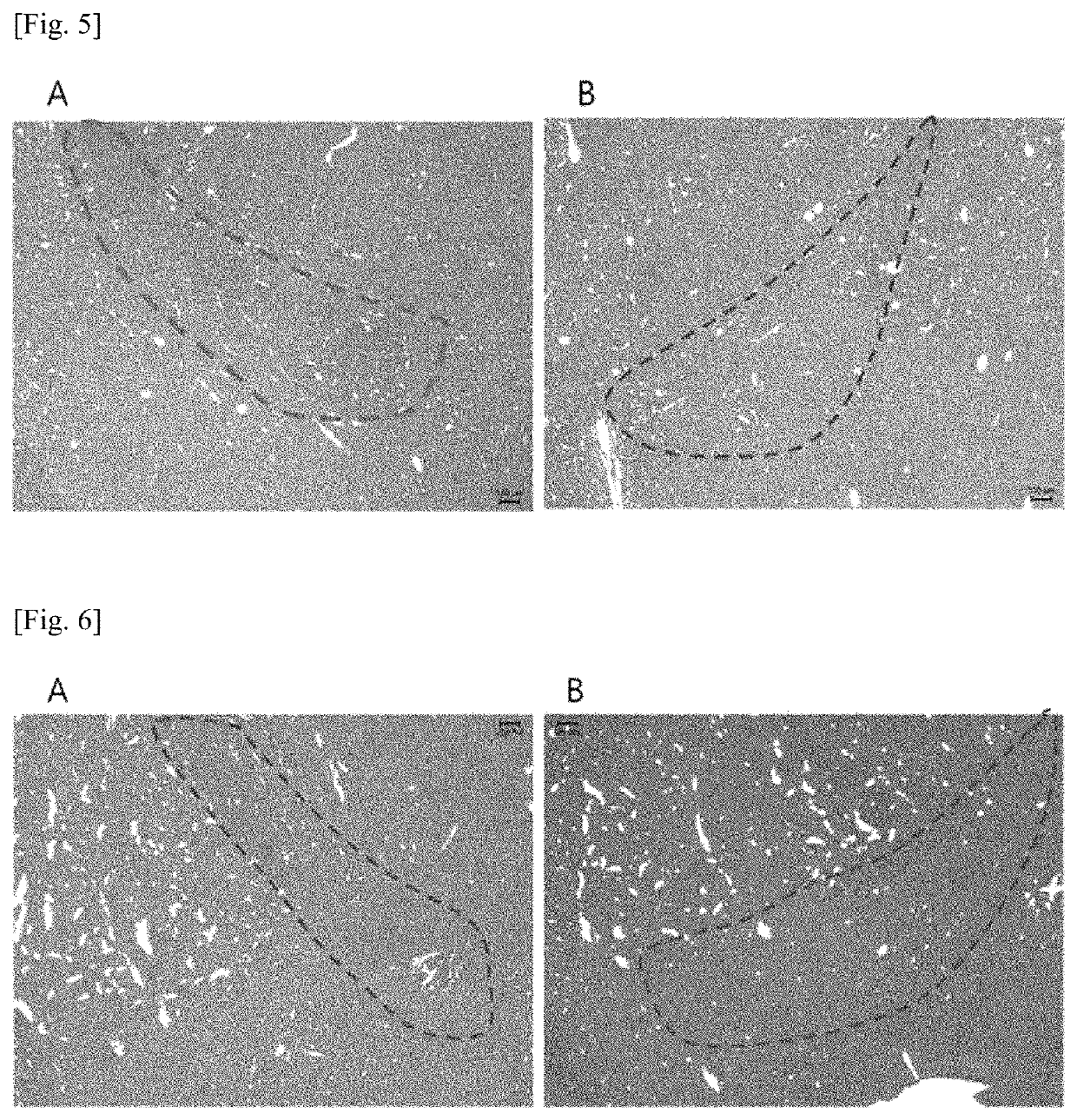 miRNA as biomarker for Parkinson's disease and diagnostic kit using same