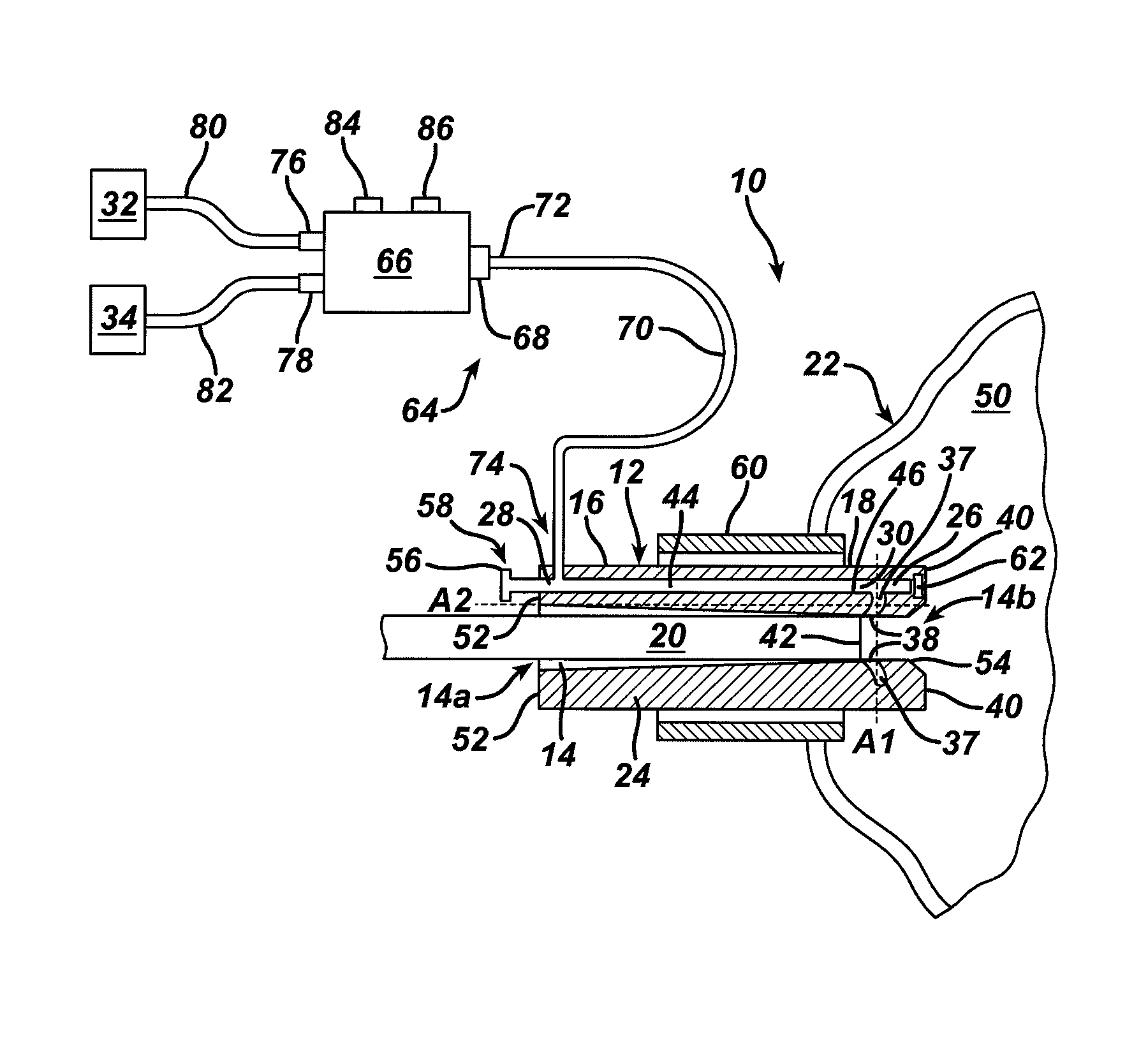 Methods and devices for maintaining visibility and providing irrigation and/or suction during surgical procedures