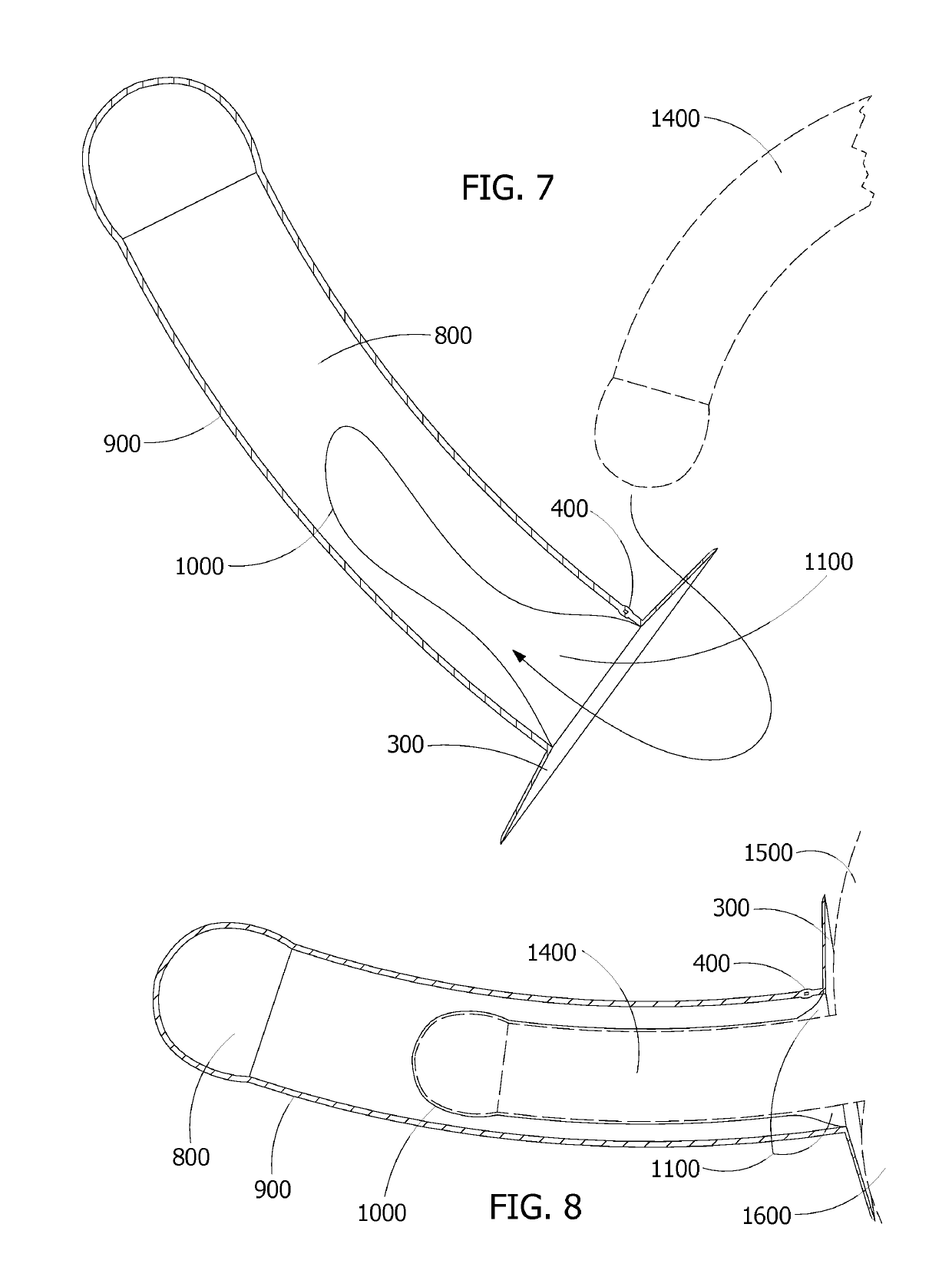 Vacuum Prosthetic Penis, System and New Method of Intercourse