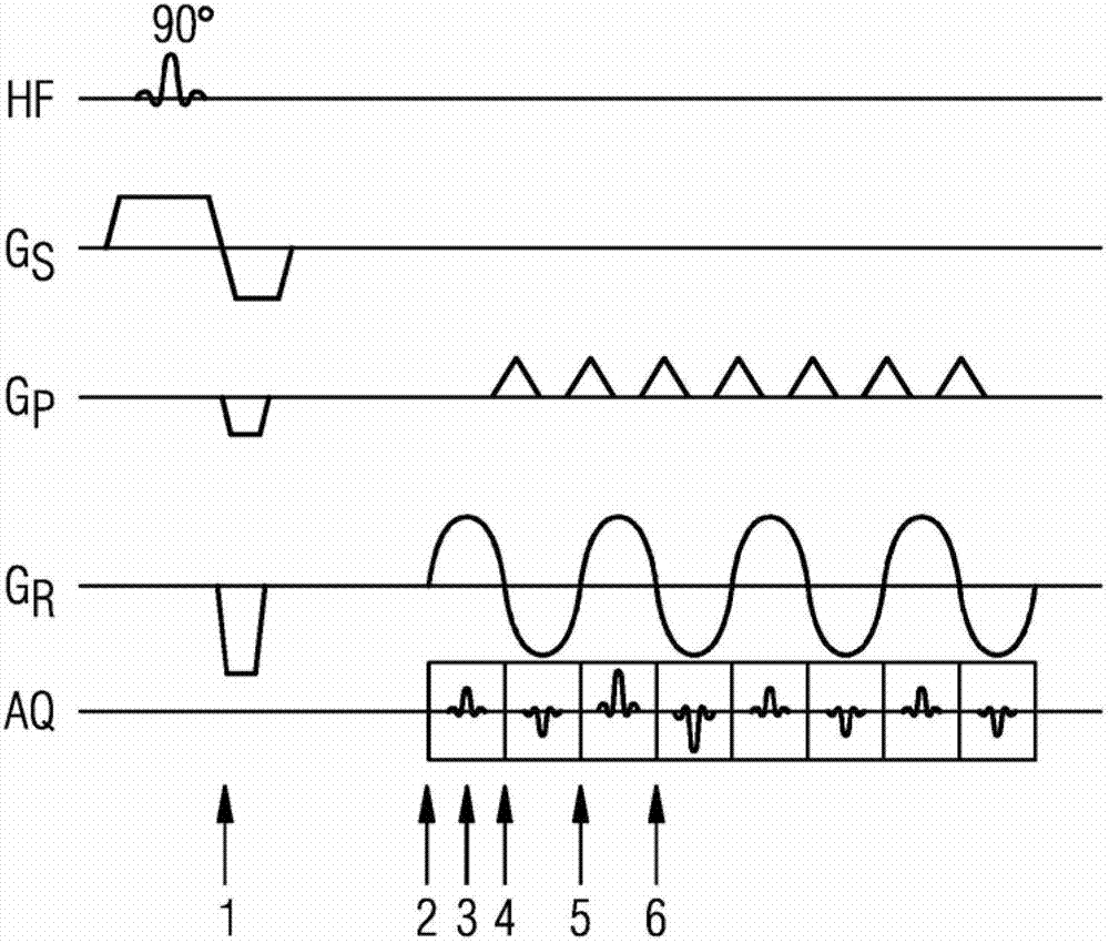 Method and magnetic resonance system for distortion correction in magnetic resonance imaging