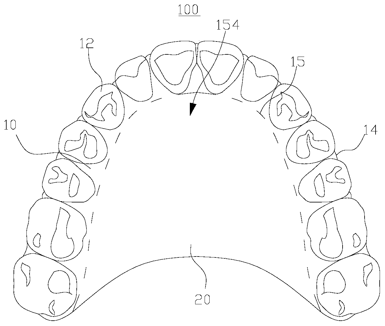 Maxillary expansion tooth socket and processing method
