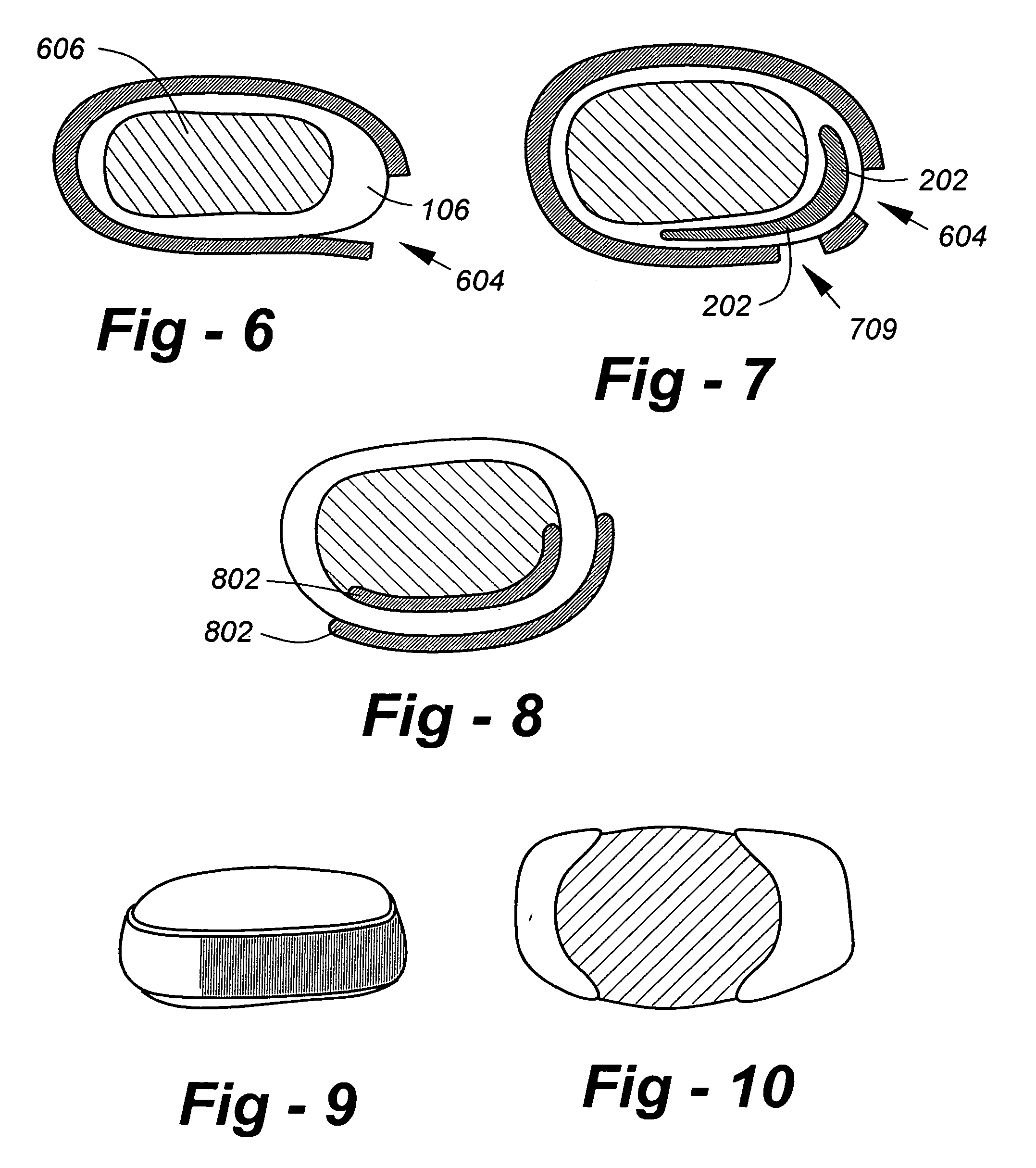 Artificial intervertebral disc replacements incorporating reinforced wall sections