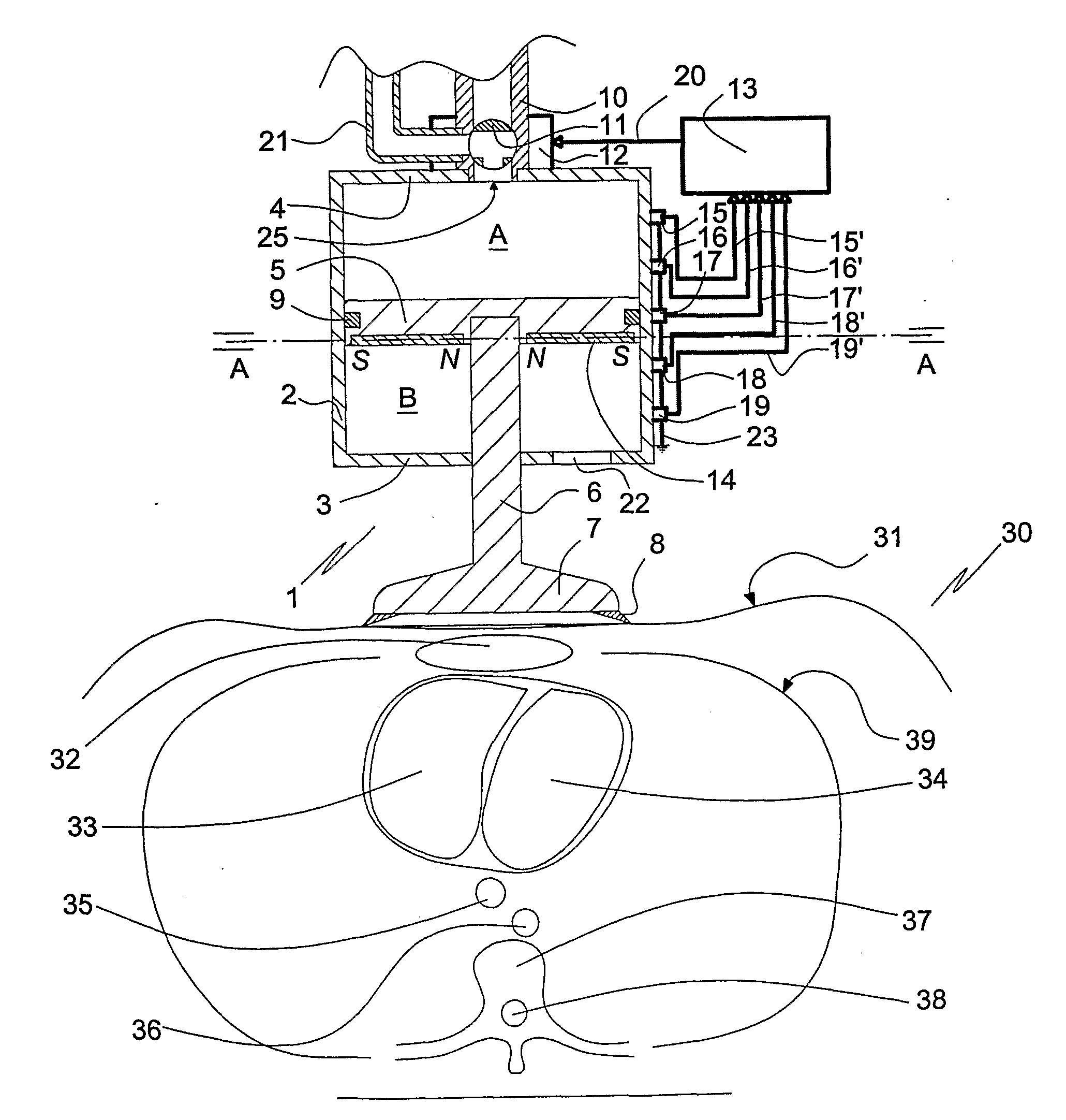Driving control of a reciprocating cpr apparatus