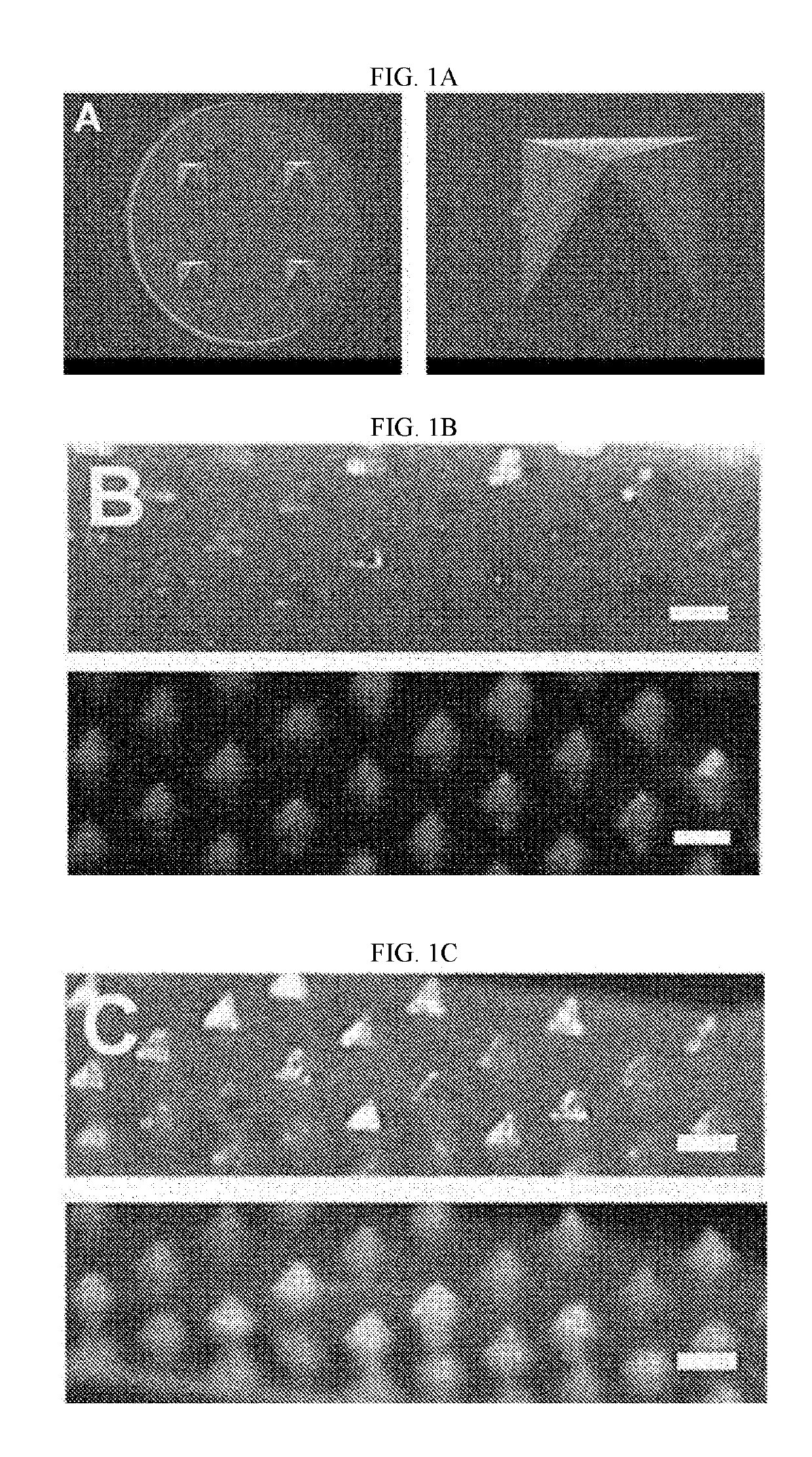 Self-assembled nanoparticle releasing soluble microneedle structure and preparation method therefor