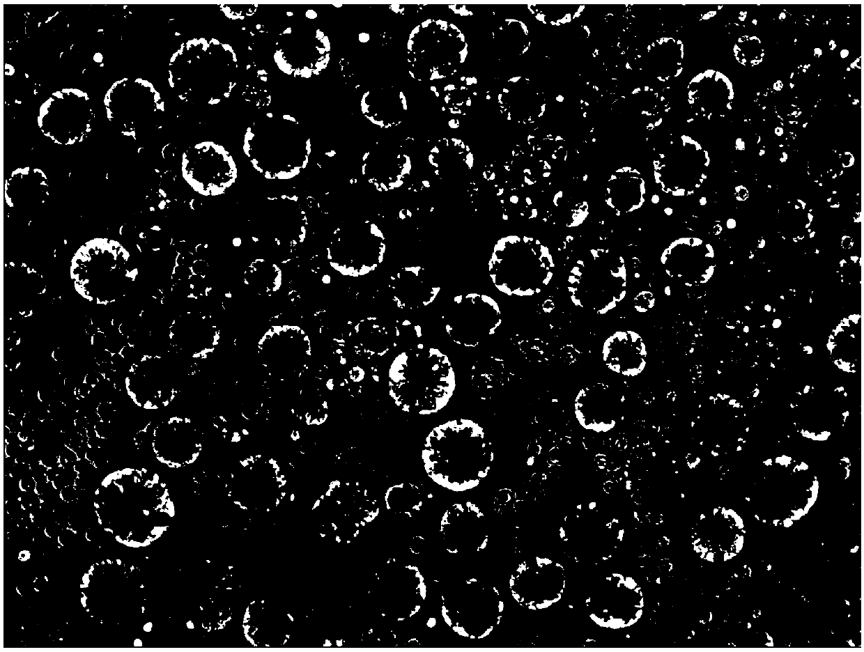 Colorectal cancer solid tumor tissue sample preserving fluid