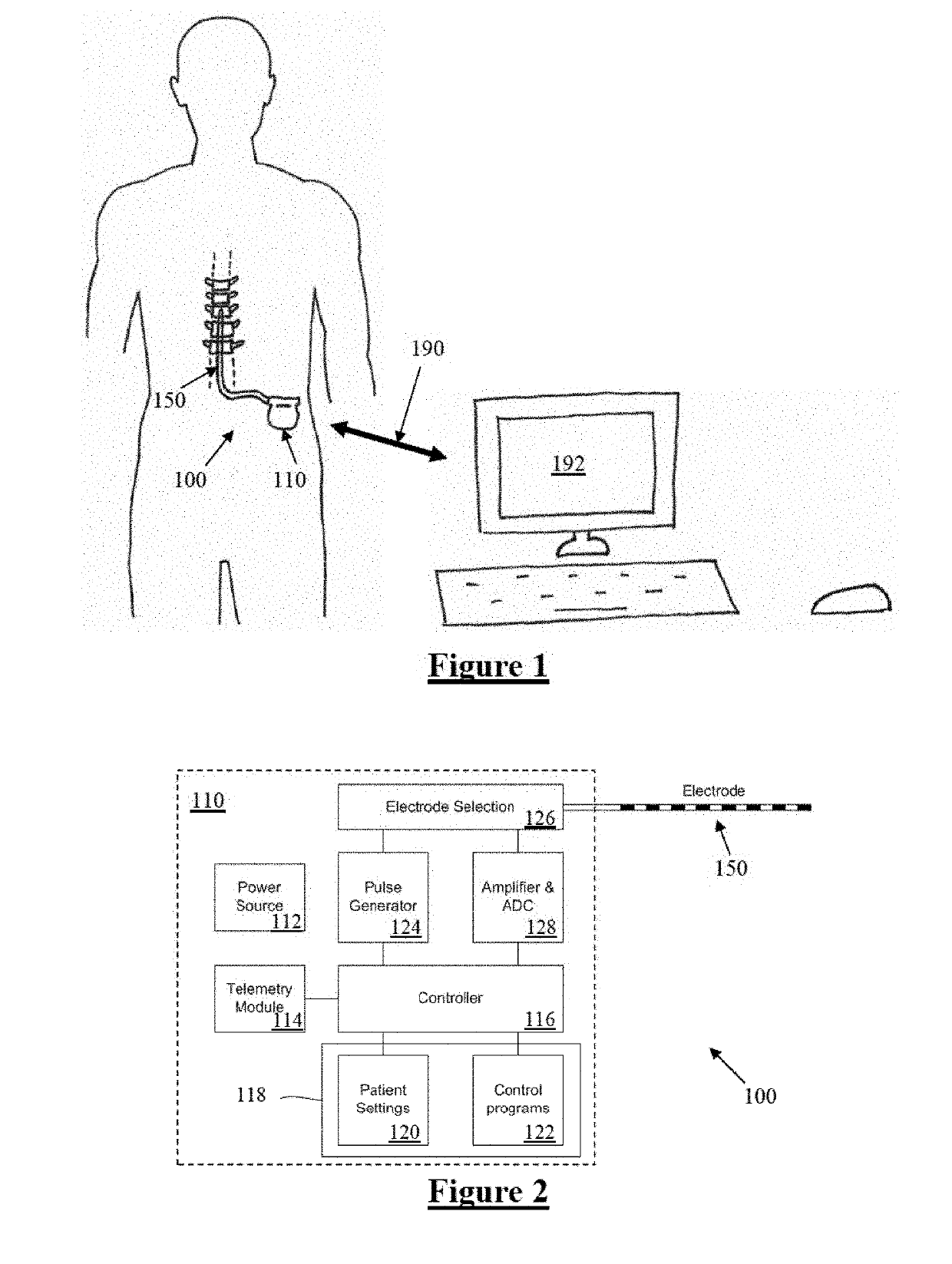 Improved Feedback Control of Neuromodulation