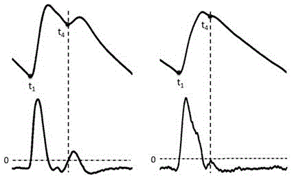 A measuring method and device for measuring systolic time parameters