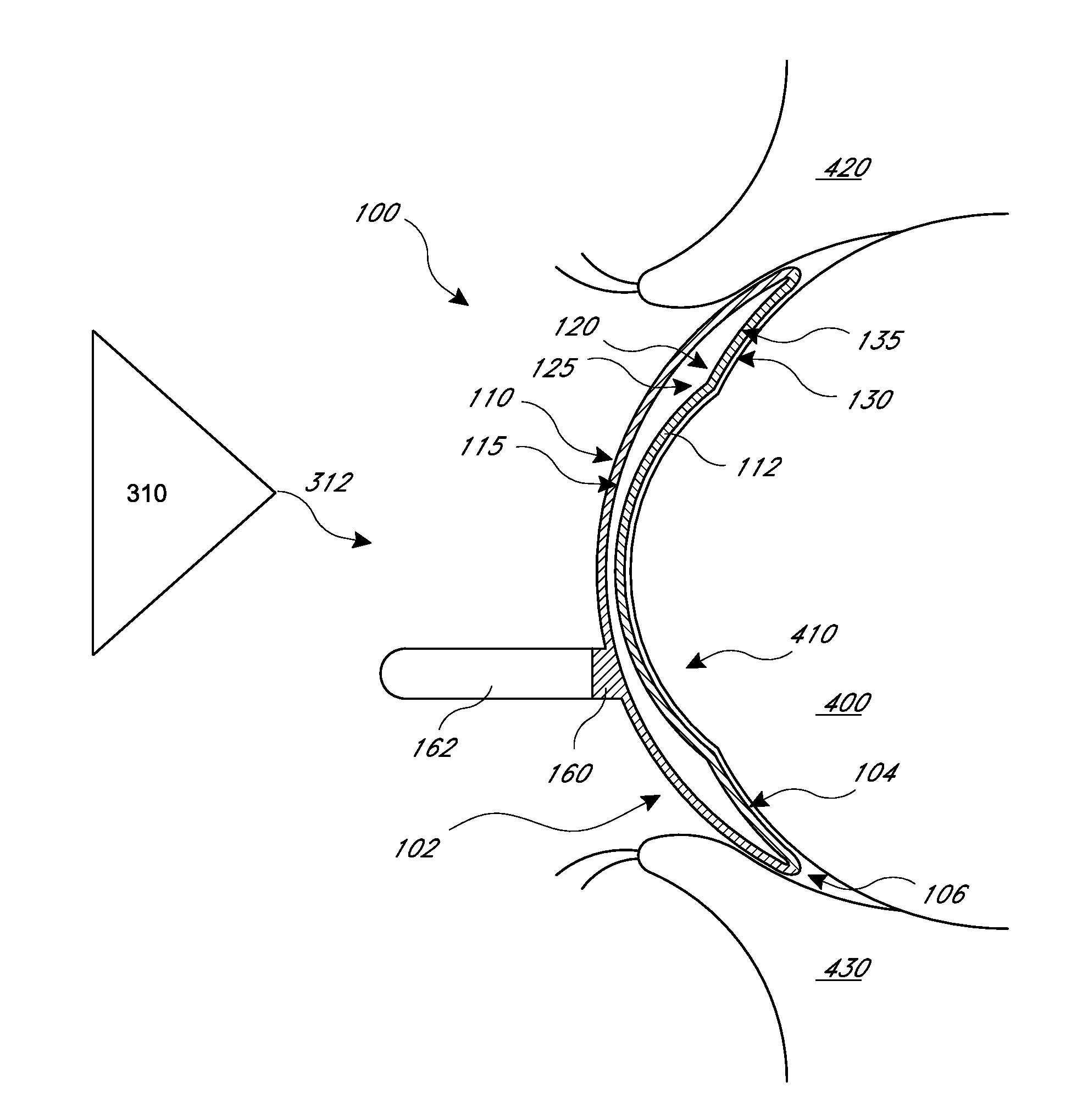 Devices and methods for acoustic shielding