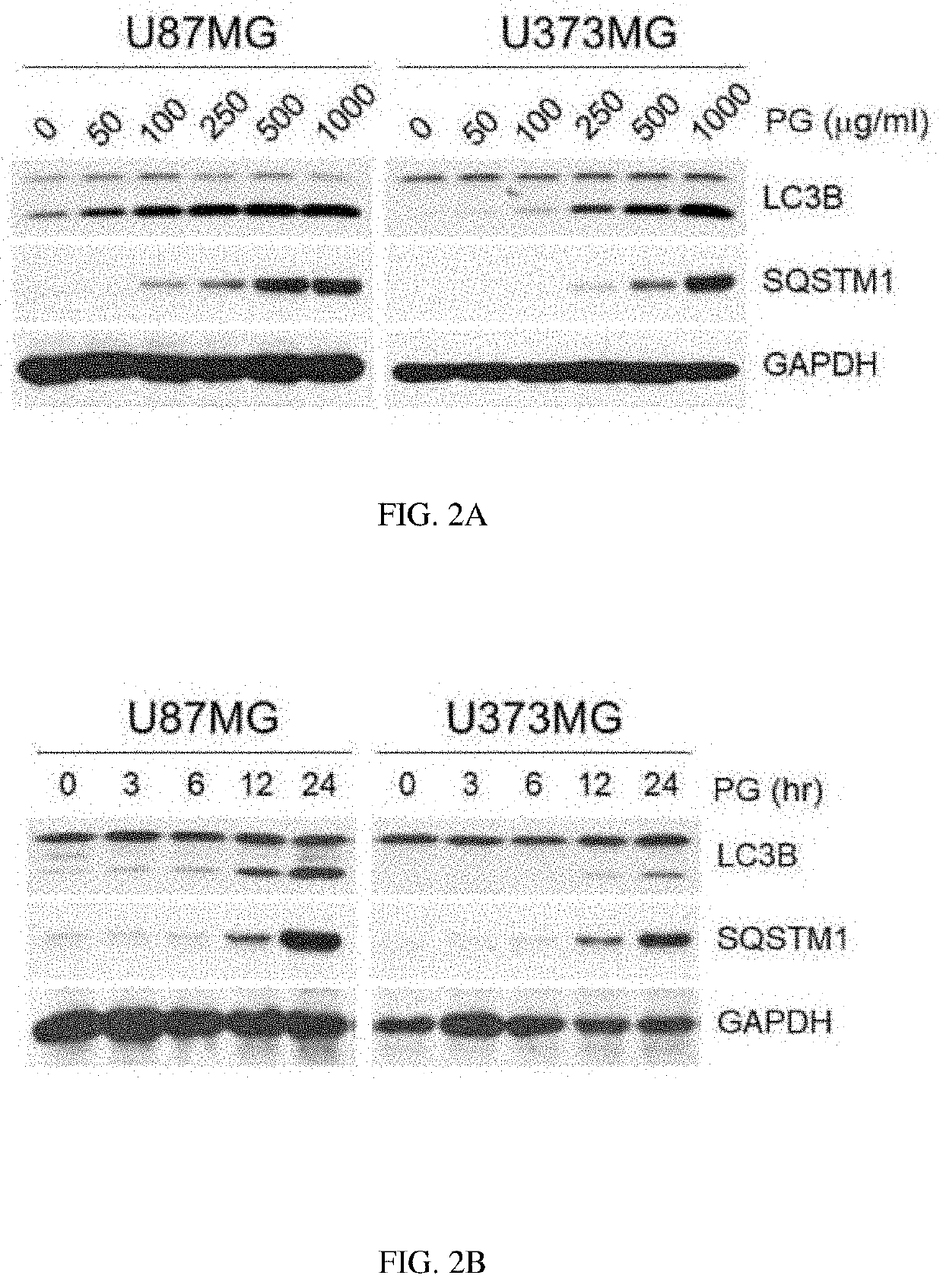 Composition for preventing or treating glioblastoma comprising platycodon grandiflorum a. de candolle, scutellaria baicalensis, phellodendron amurense ruprecht or rubus coreanus