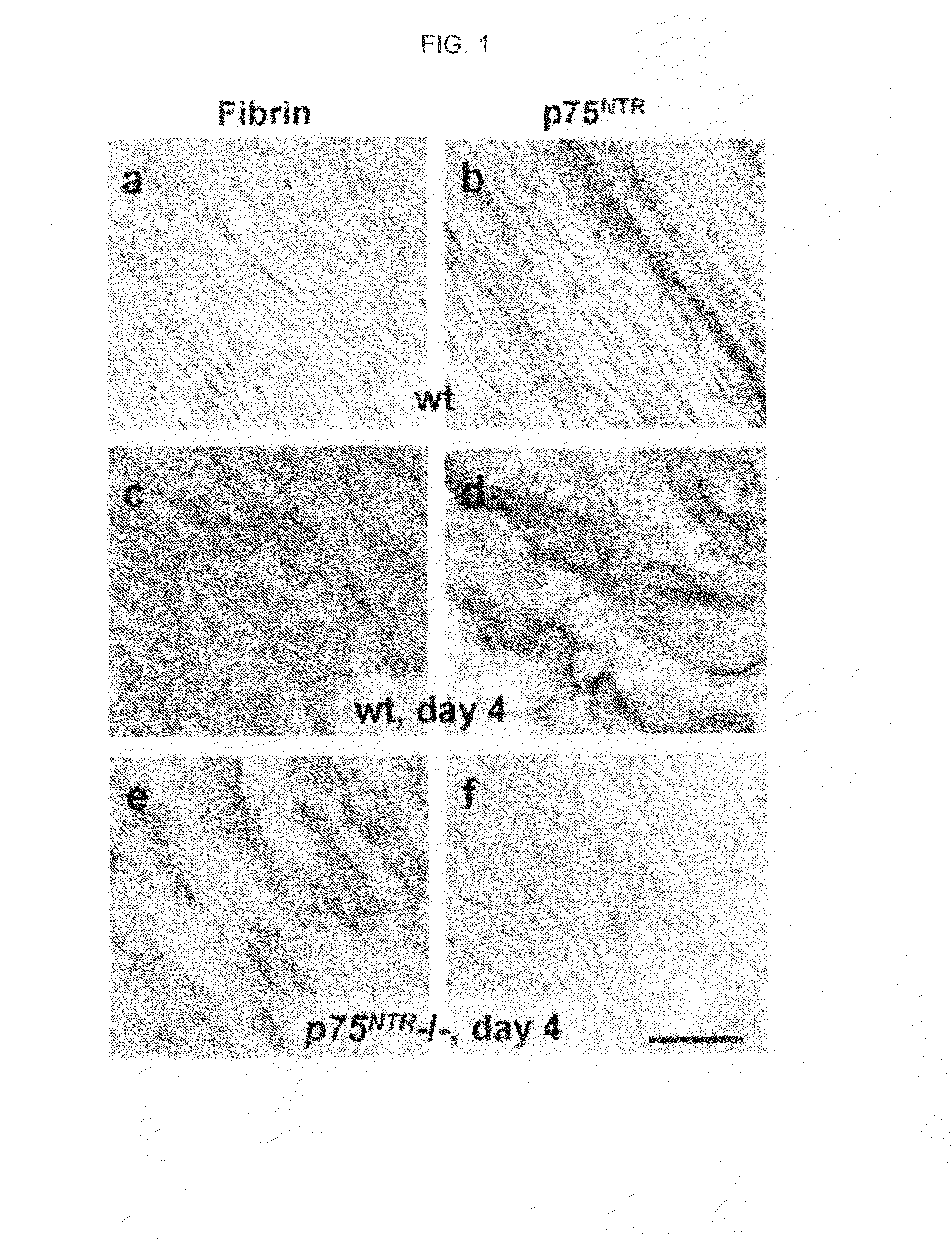 Inhibitors of PDE4 and Methods of Use