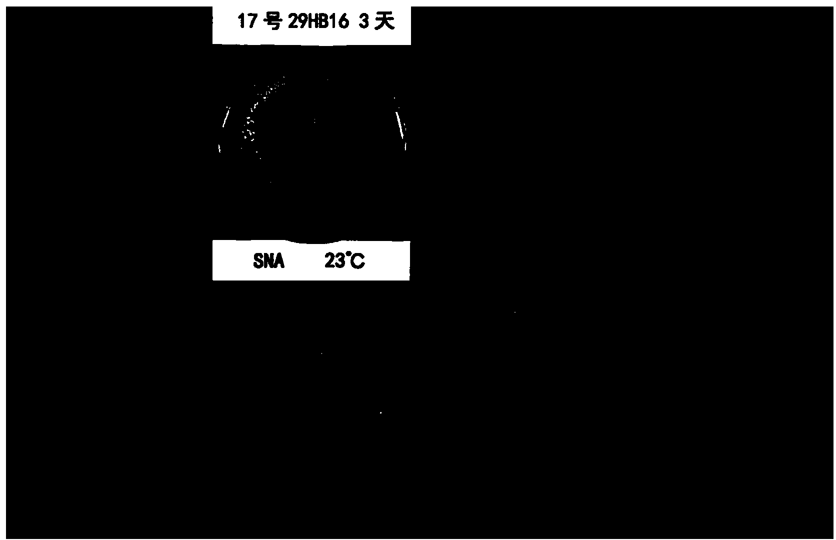 Saline-alkali tolerant trichoderma harzianum and application thereof
