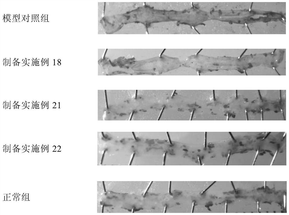 A pharmaceutical composition for treating hyperlipidemia and atherosclerosis