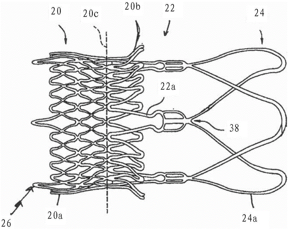 Method and apparatus for compressing/loading stent-valves