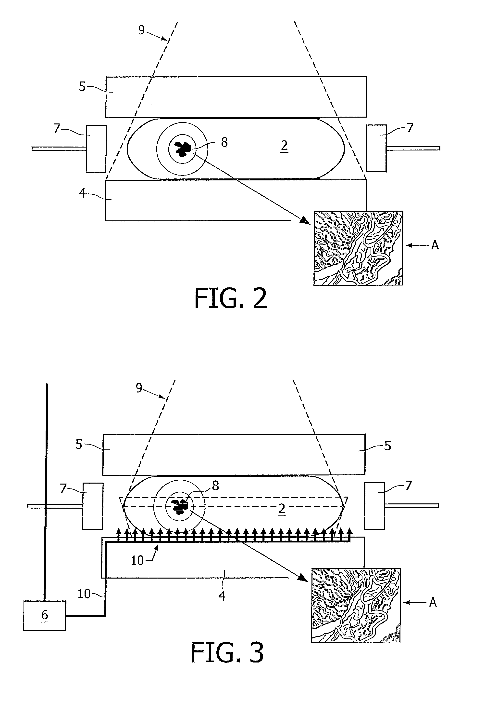 Mammography-Apparatus and Method for Screening the Occurrence of Malignant Cells