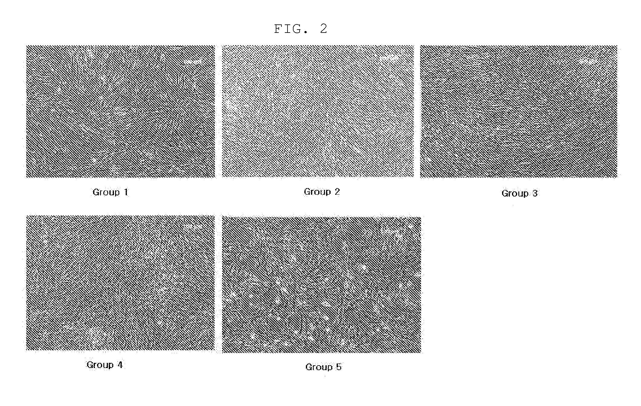 Culture medium composition for culturing amnion-derived mesenchymal stem cell, and method for culturing amnion-derived mesenchymal stem cell by using same