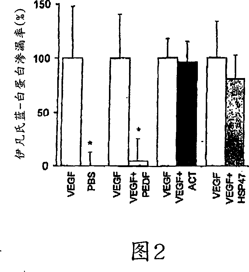 Biological activity of pigment epithelium-derived factor and methods of use