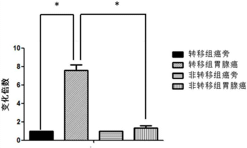 Application of MCM8 as gastric adenocarcinoma metastasis marker