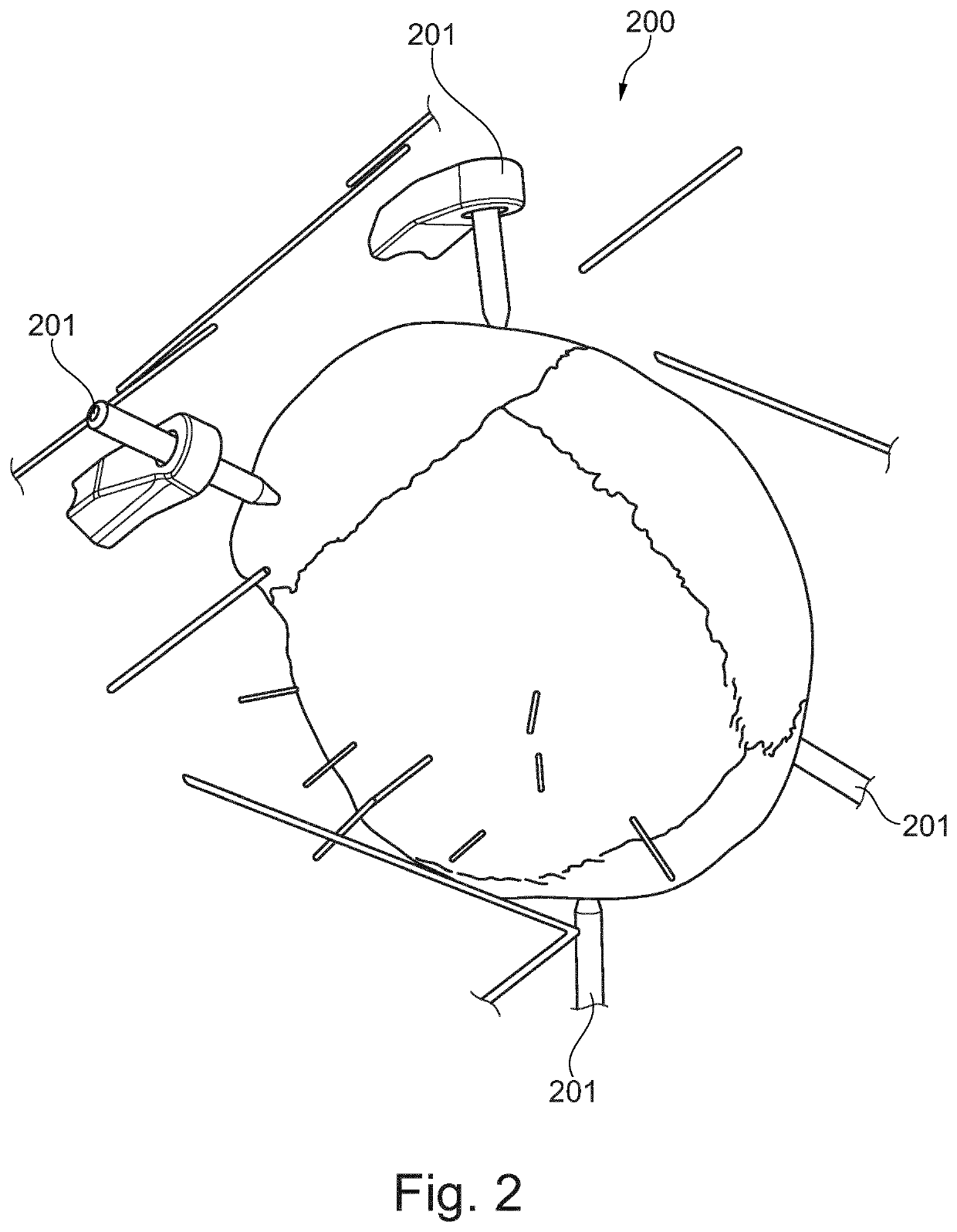 Automated pre-operative assessment of implant placement in human bone