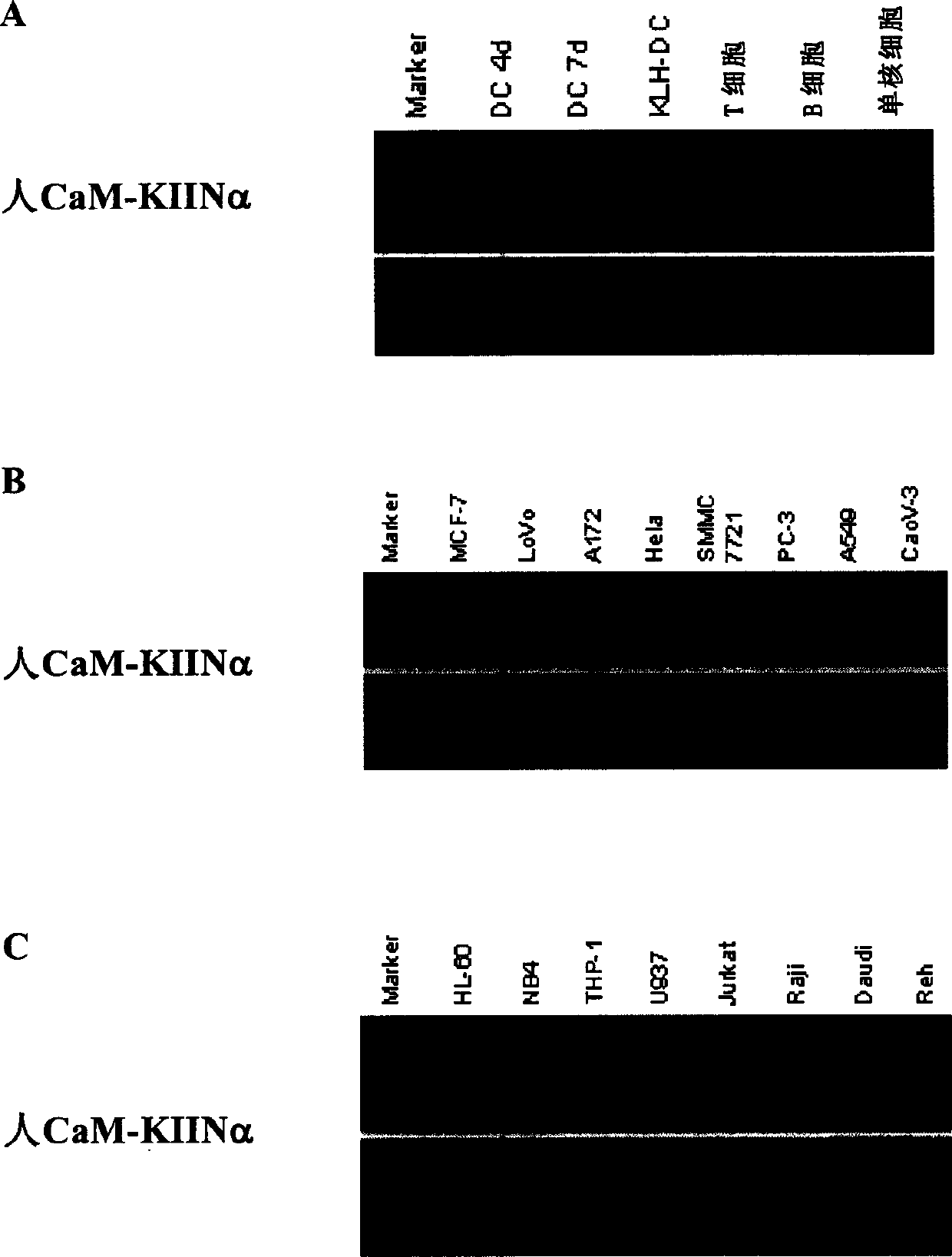 Human calcium ion / calmodulin deopendent protein kinase II inhibitory protein alpha, its coded sequence and use