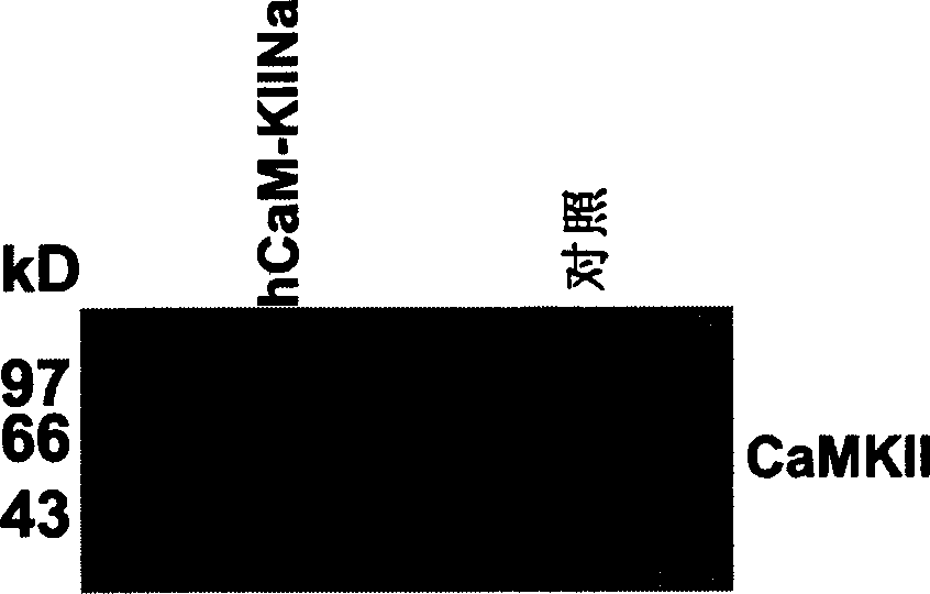 Human calcium ion / calmodulin deopendent protein kinase II inhibitory protein alpha, its coded sequence and use