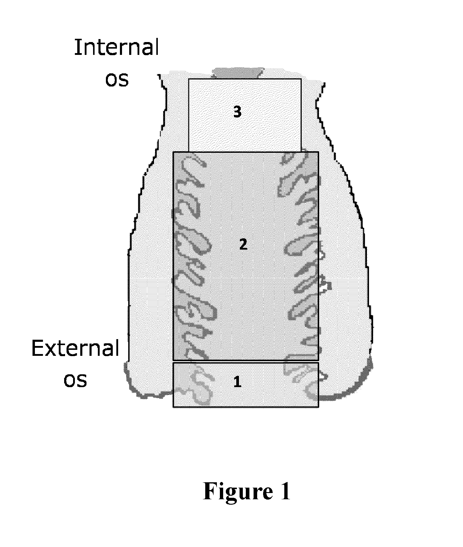 Methods of enriching and detecting fetal nucleic acids
