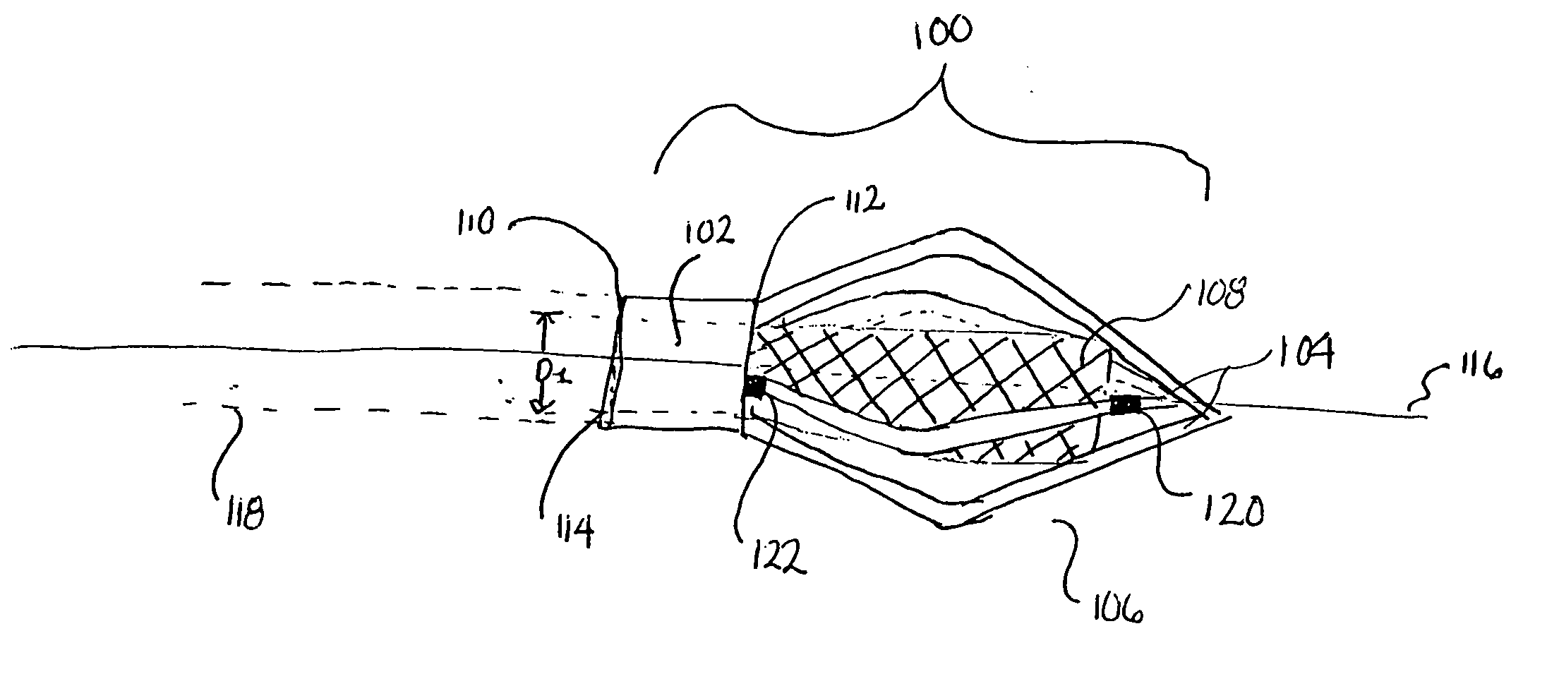 Method and apparatus for caged stent delivery