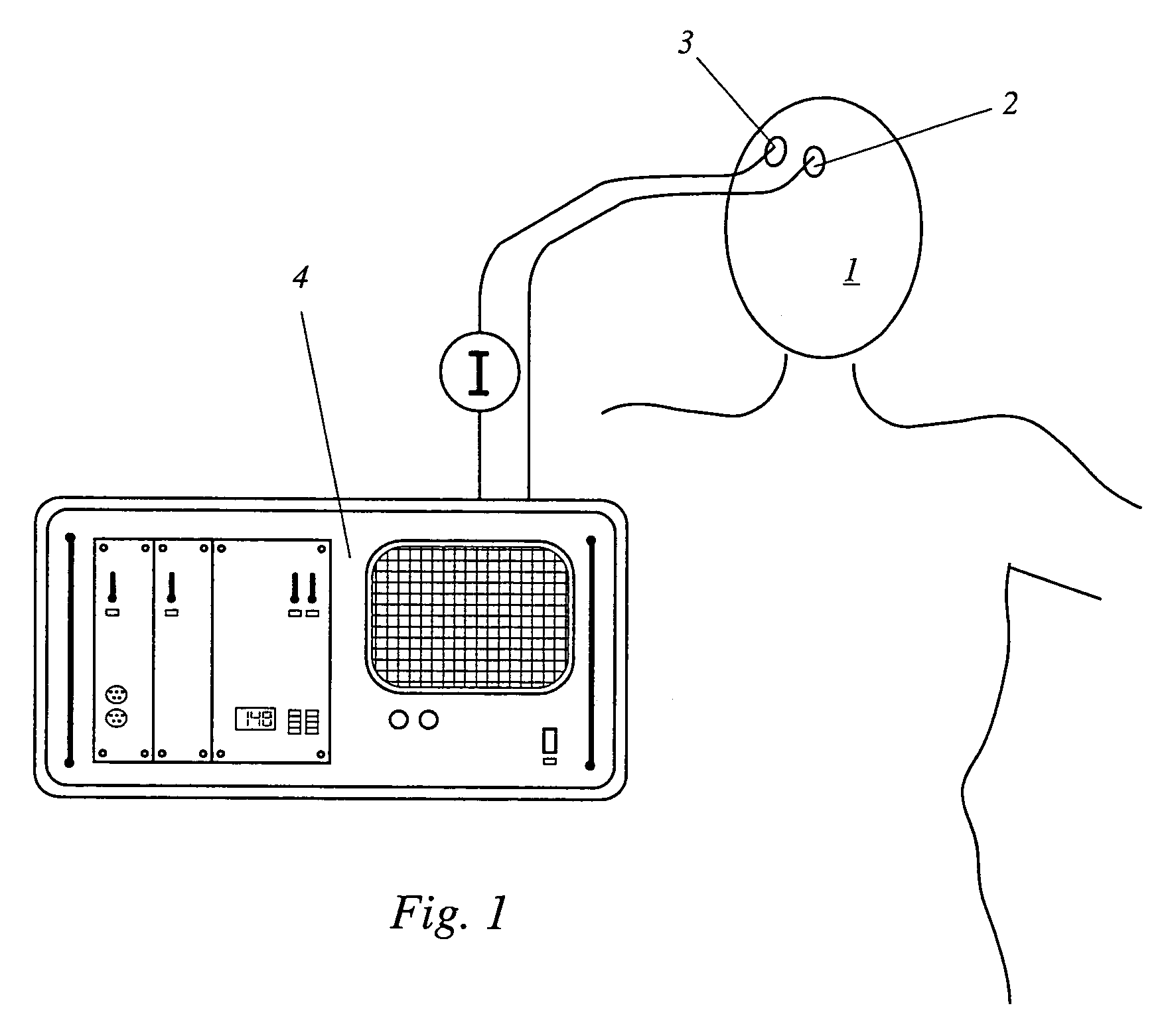 Device and method for measuring blood flow in an organ