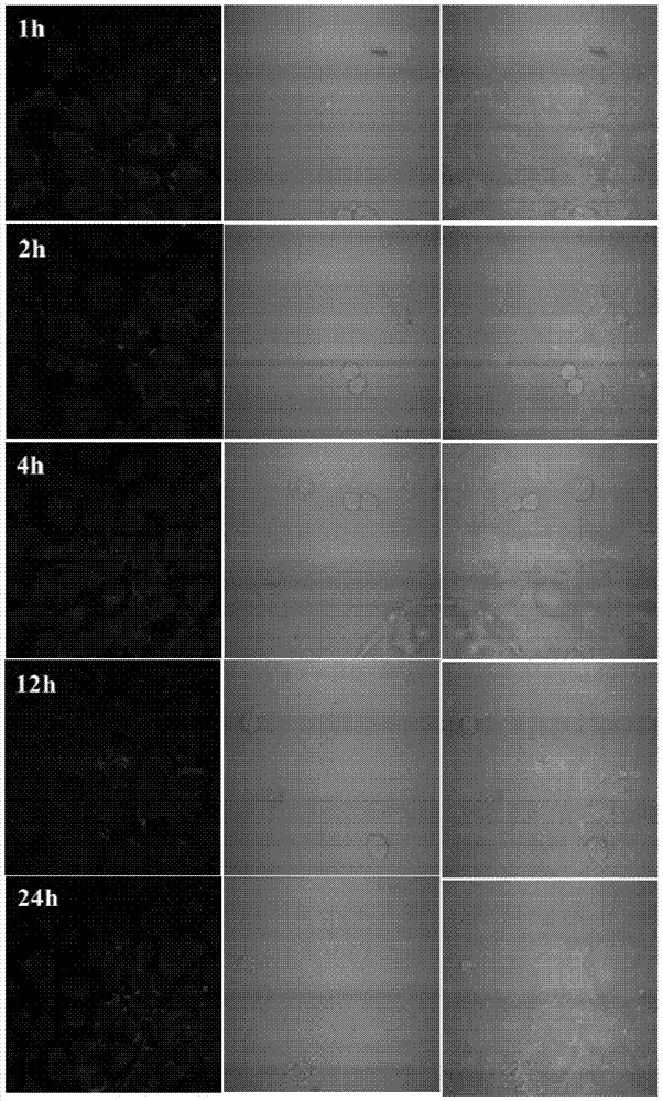 Amphiphilic block copolymer and nanoparticles comprising the same, preparation method and application thereof