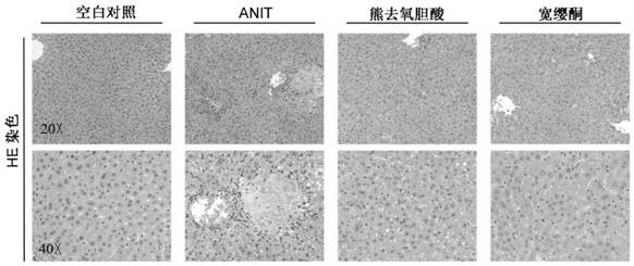 Application of quassin type diterpenoid compound in preparation of medicine for treating cholestatic liver disease