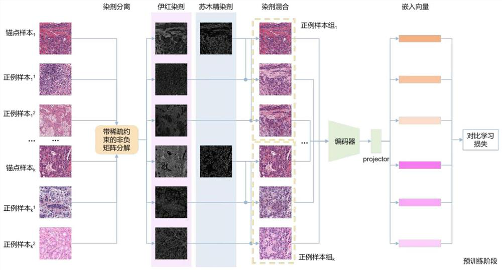Semi-supervised learning method for carrying out cell nucleus segmentation on histopathological image