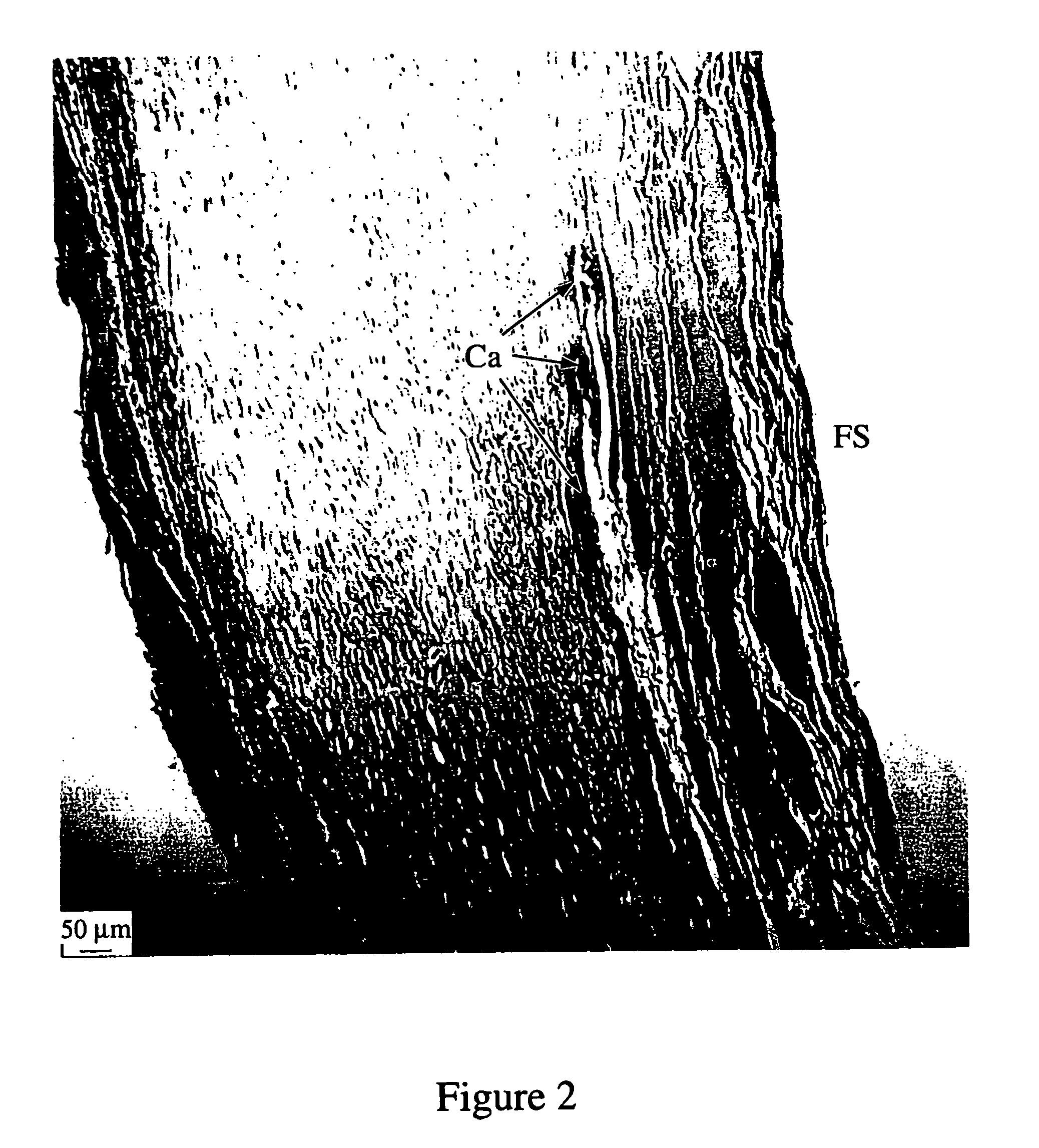 Method of creating biological and biosynthetic material for implantation