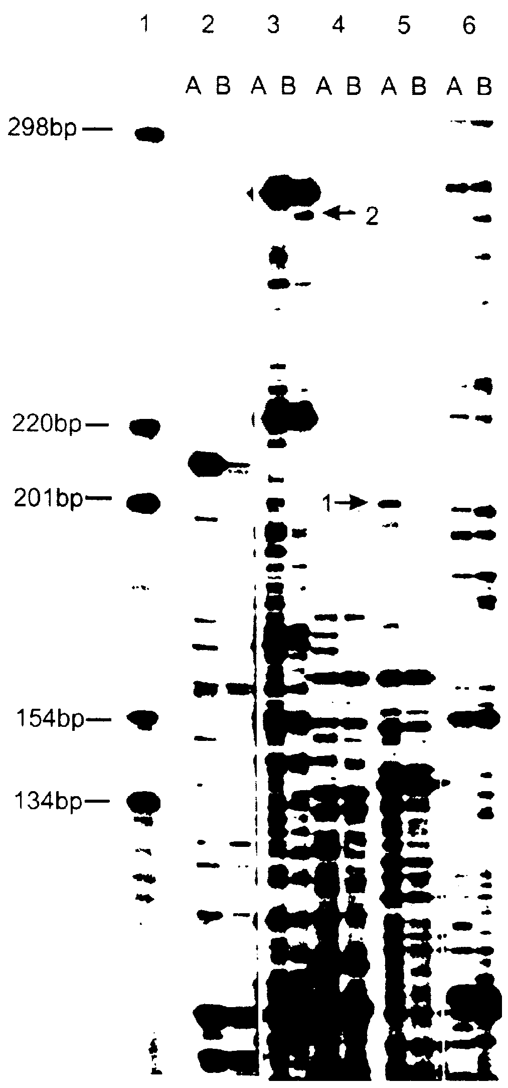 Method of identification and cloning differentially expressed messenger RNAs