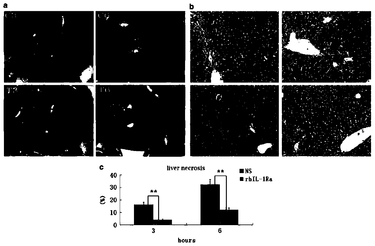 Application of rhIL-1Ra in preparing medicaments for treating acute liver failure