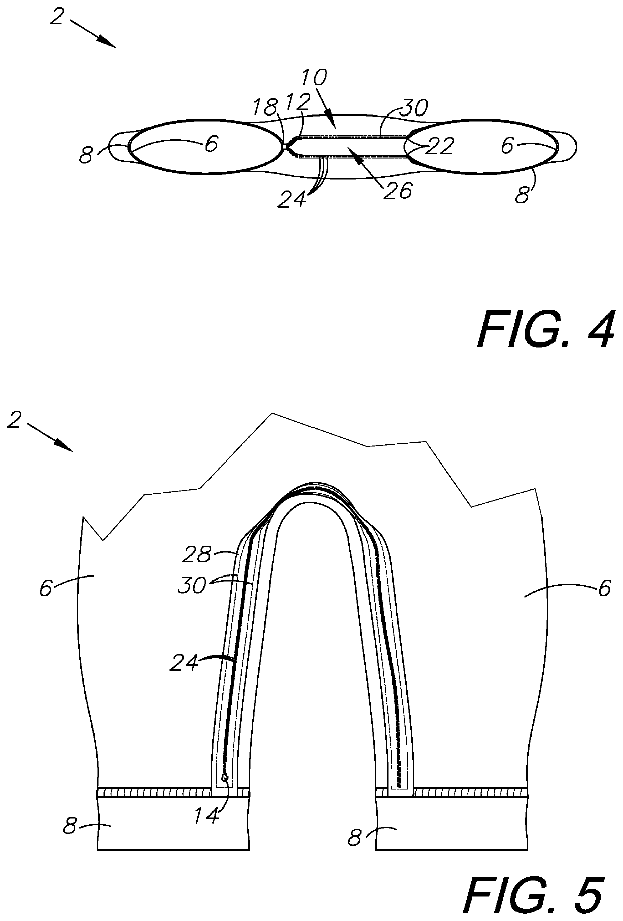Child clothing device with reinforced zipper access, method of use, and method of manufacture