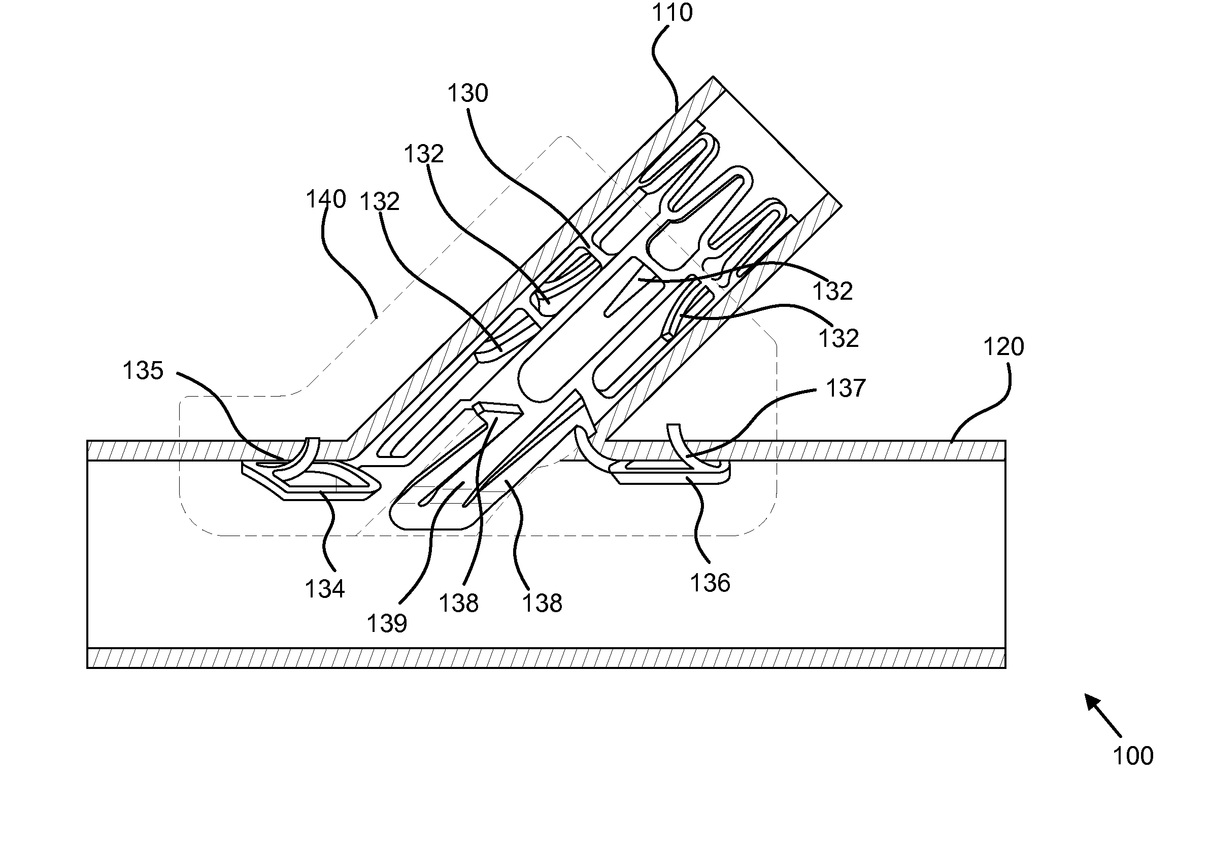 Deployment tool for sutureless vascular anastomosis connection