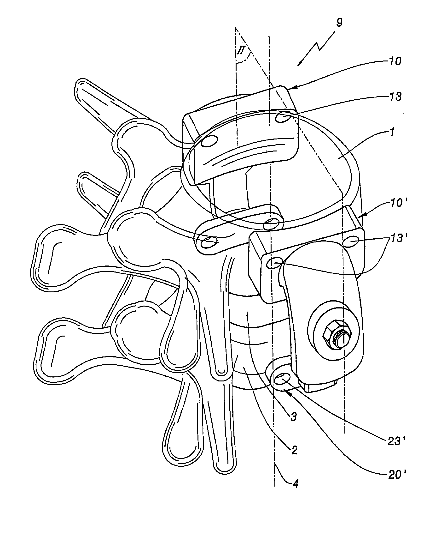 Device for the lateral stabilization of the spine