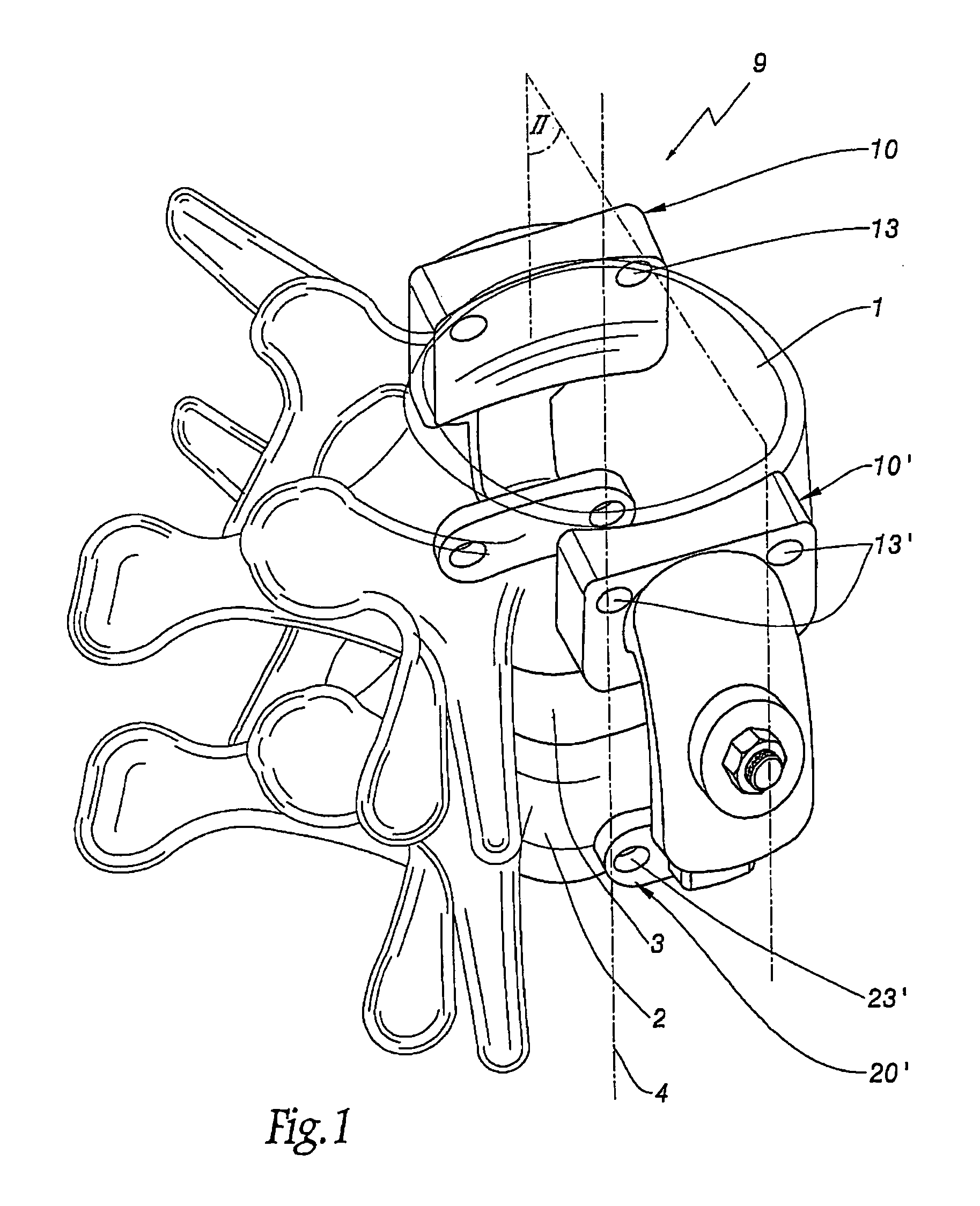 Device for the lateral stabilization of the spine