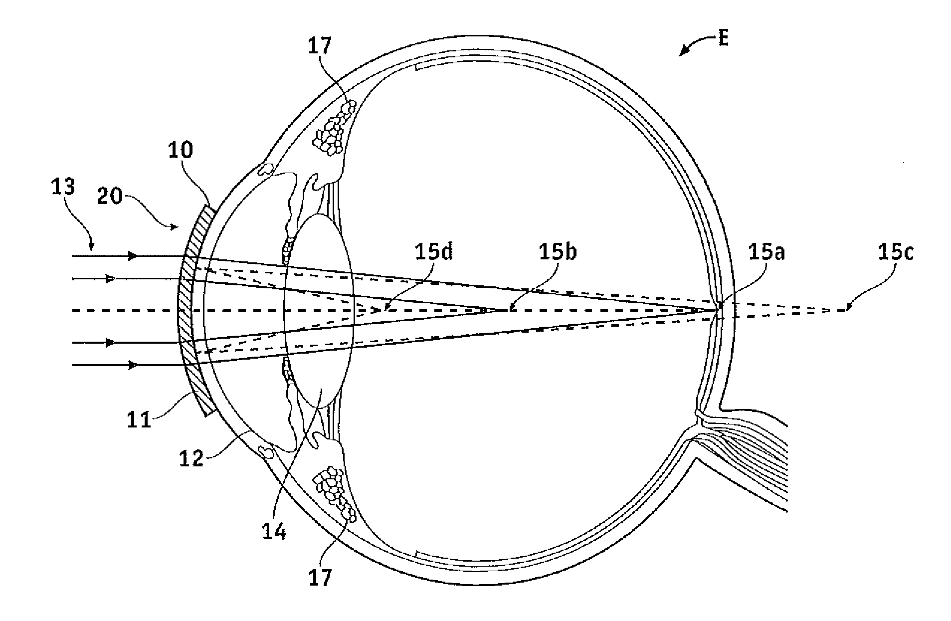 Pupil dependent diffractive lens for near, intermediate, and far vision
