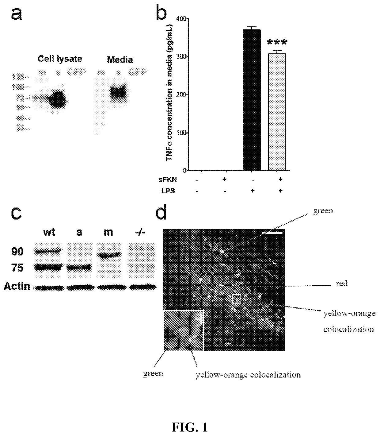 Recombinant adeno-associated virus-mediated expression of fractalkine for treatment of neuroinflammatory and neurodegenerative diseases